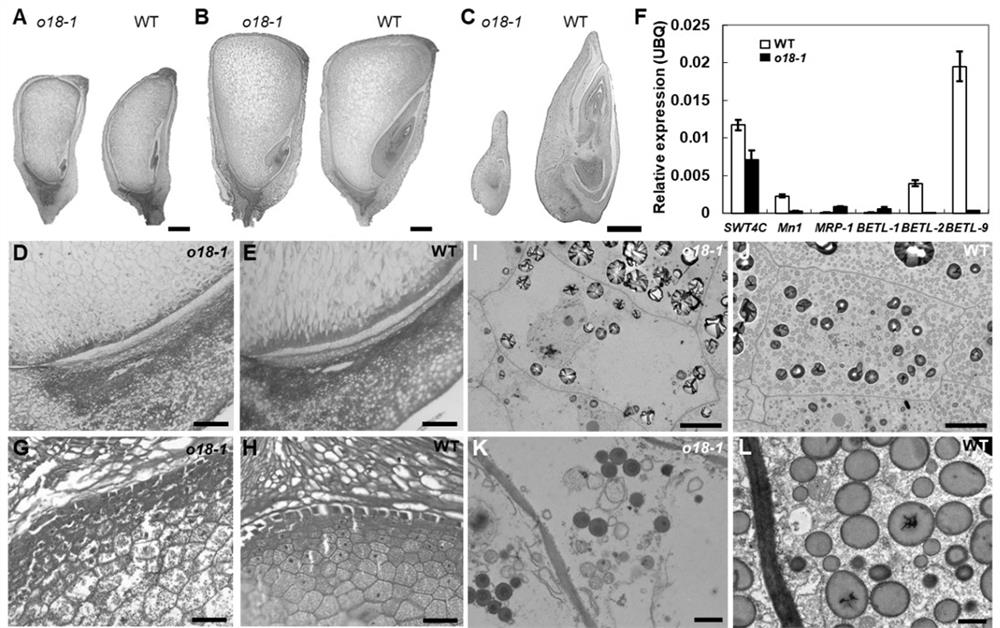 Application of corn ZmRIBA1 gene in breeding of high-lysine corn