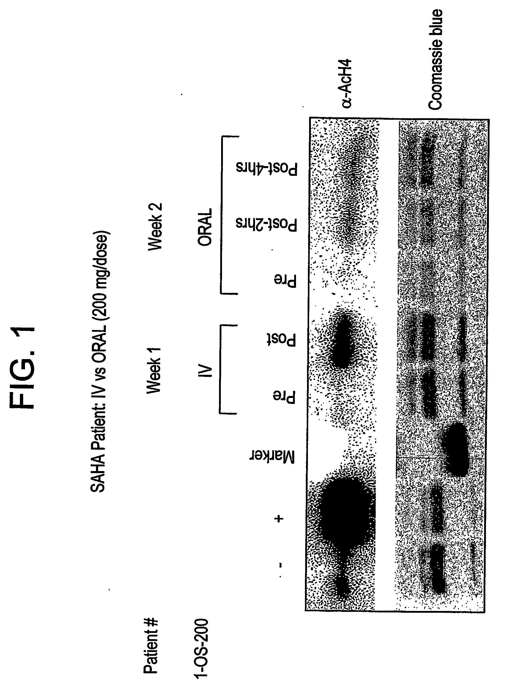 Methods of treating cancer with hdac inhibitors