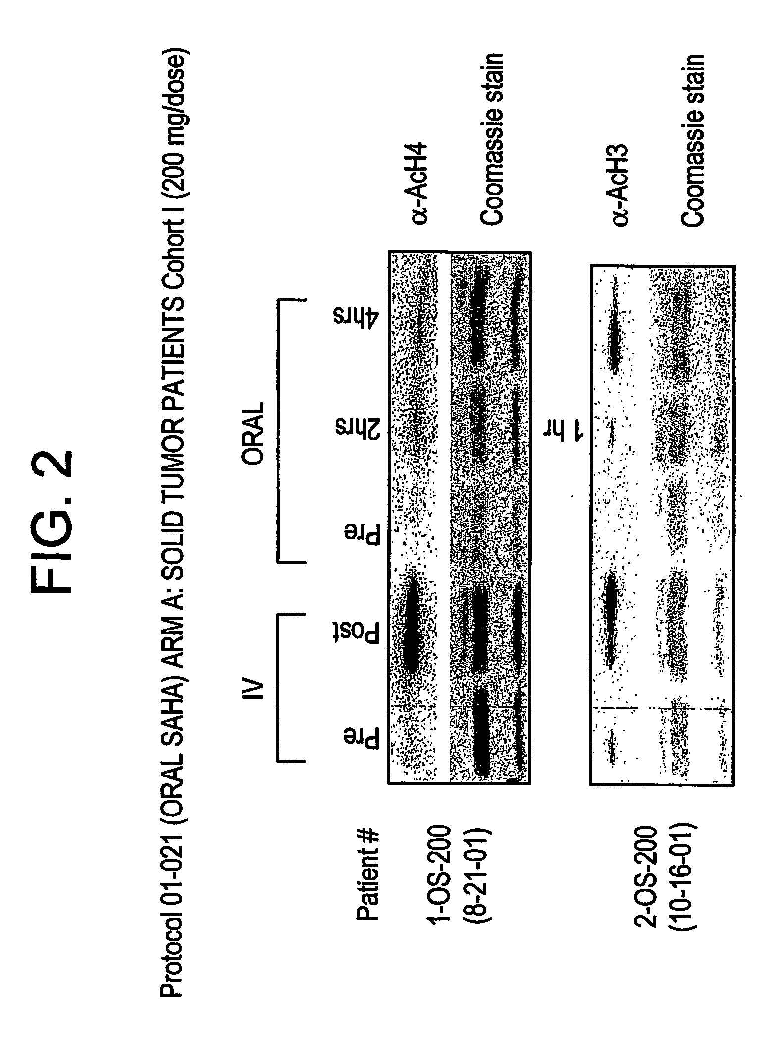Methods of treating cancer with hdac inhibitors
