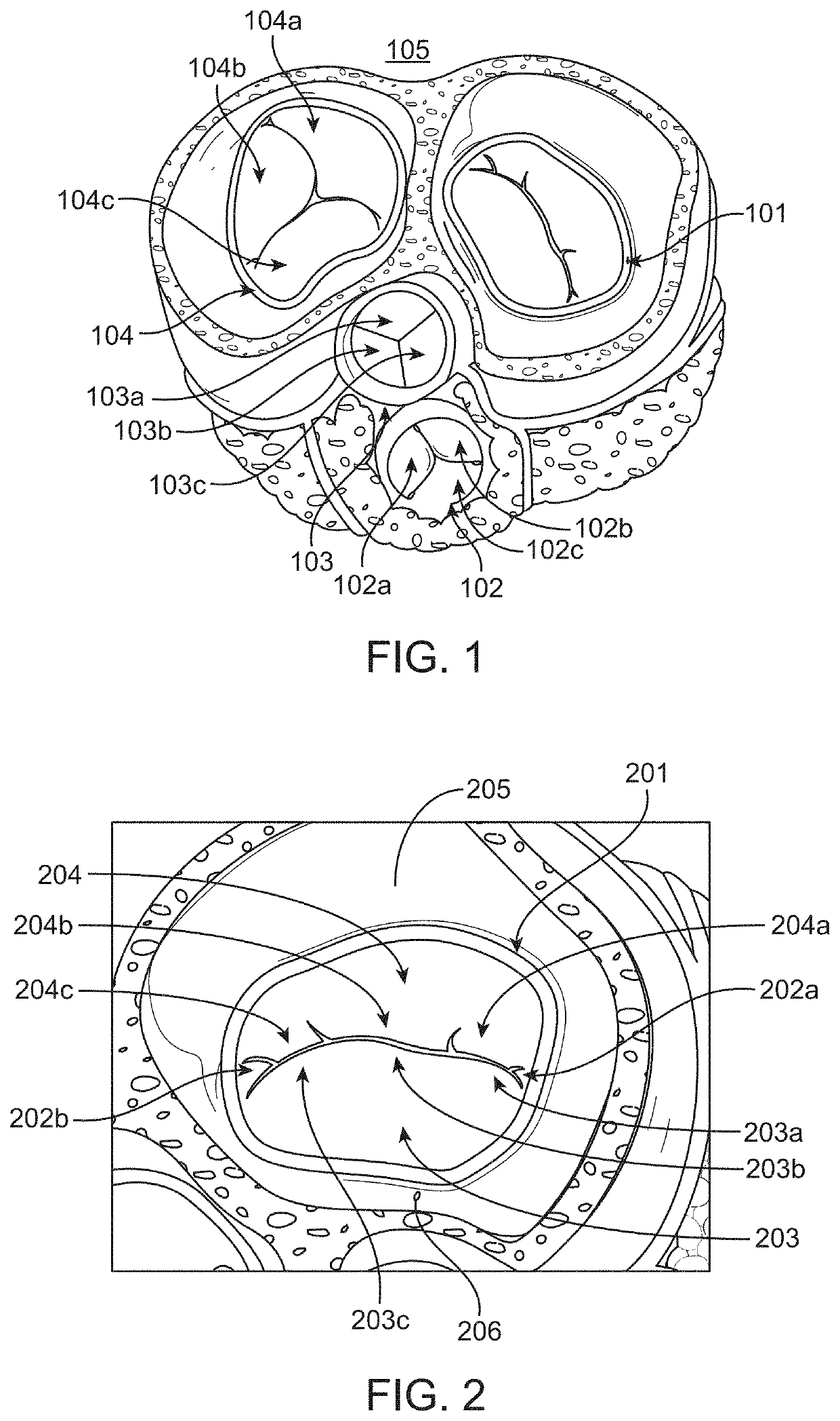 Methods and devices for heart valve repair