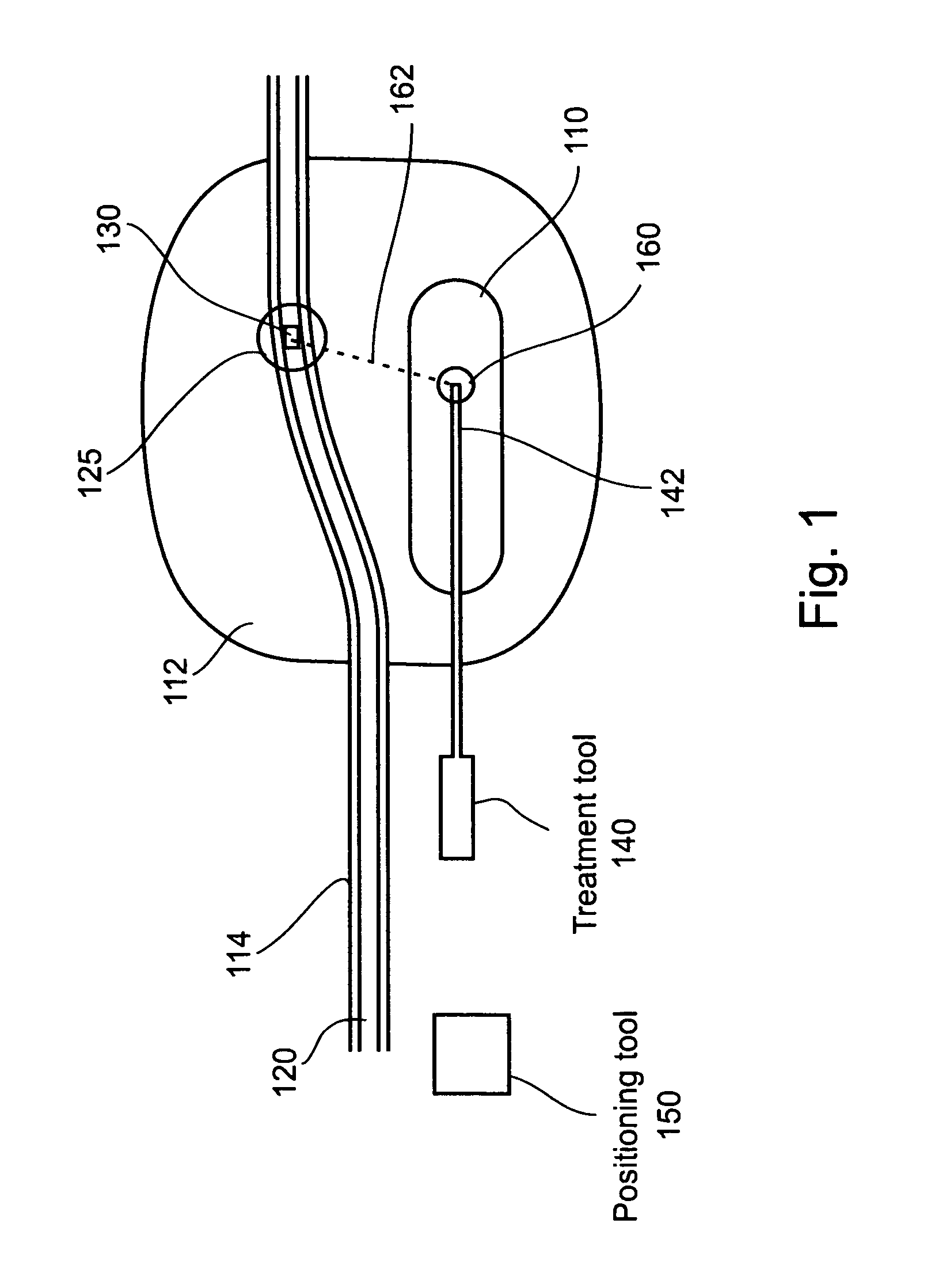 Method and apparatus for positioning a surgical instrument