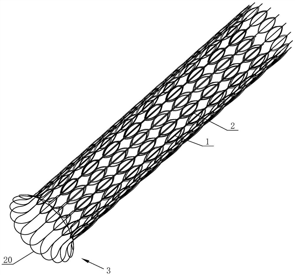 Self-expansion in-vivo absorption biliary tract stent