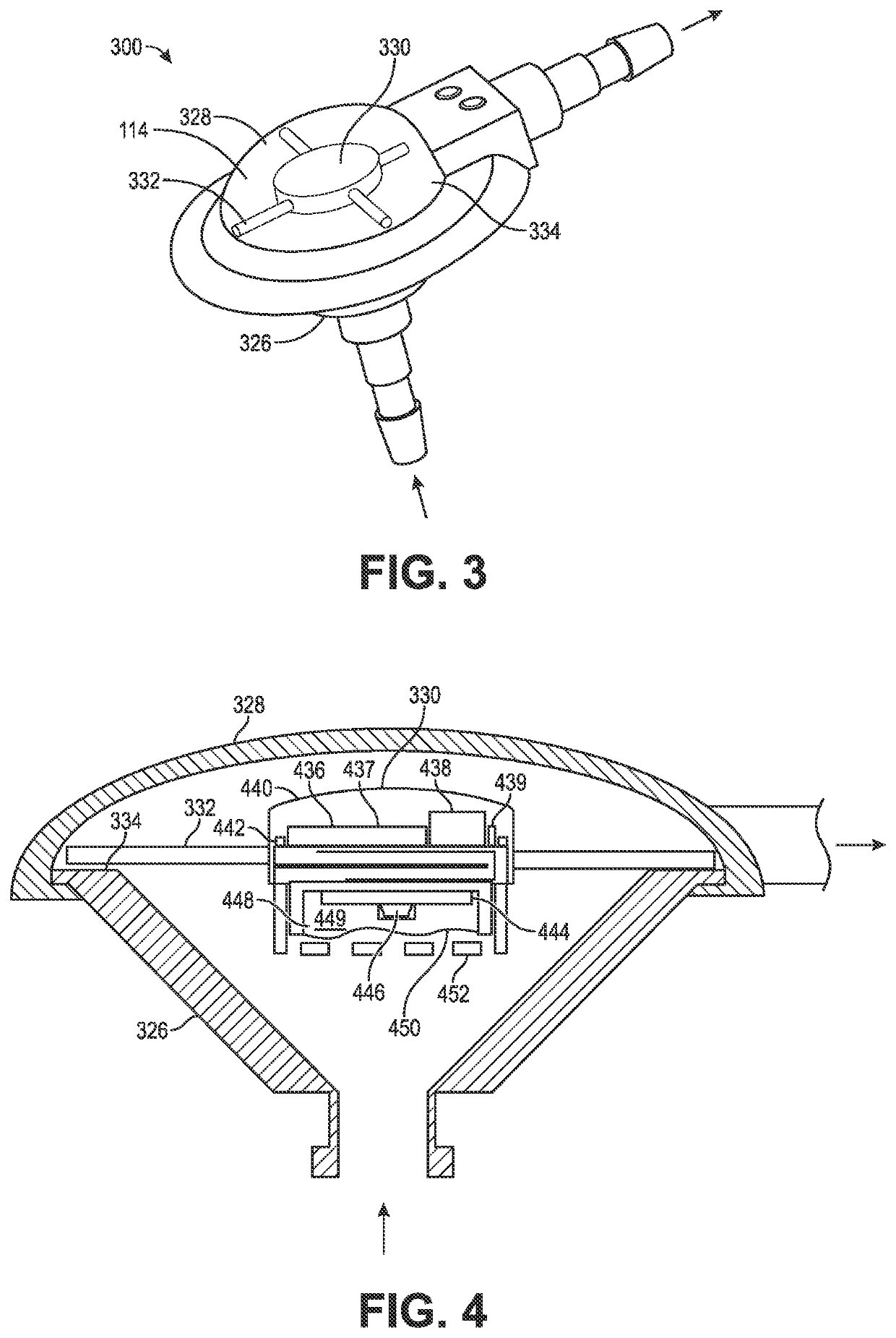 Implantable Intracranial Pressure Sensor