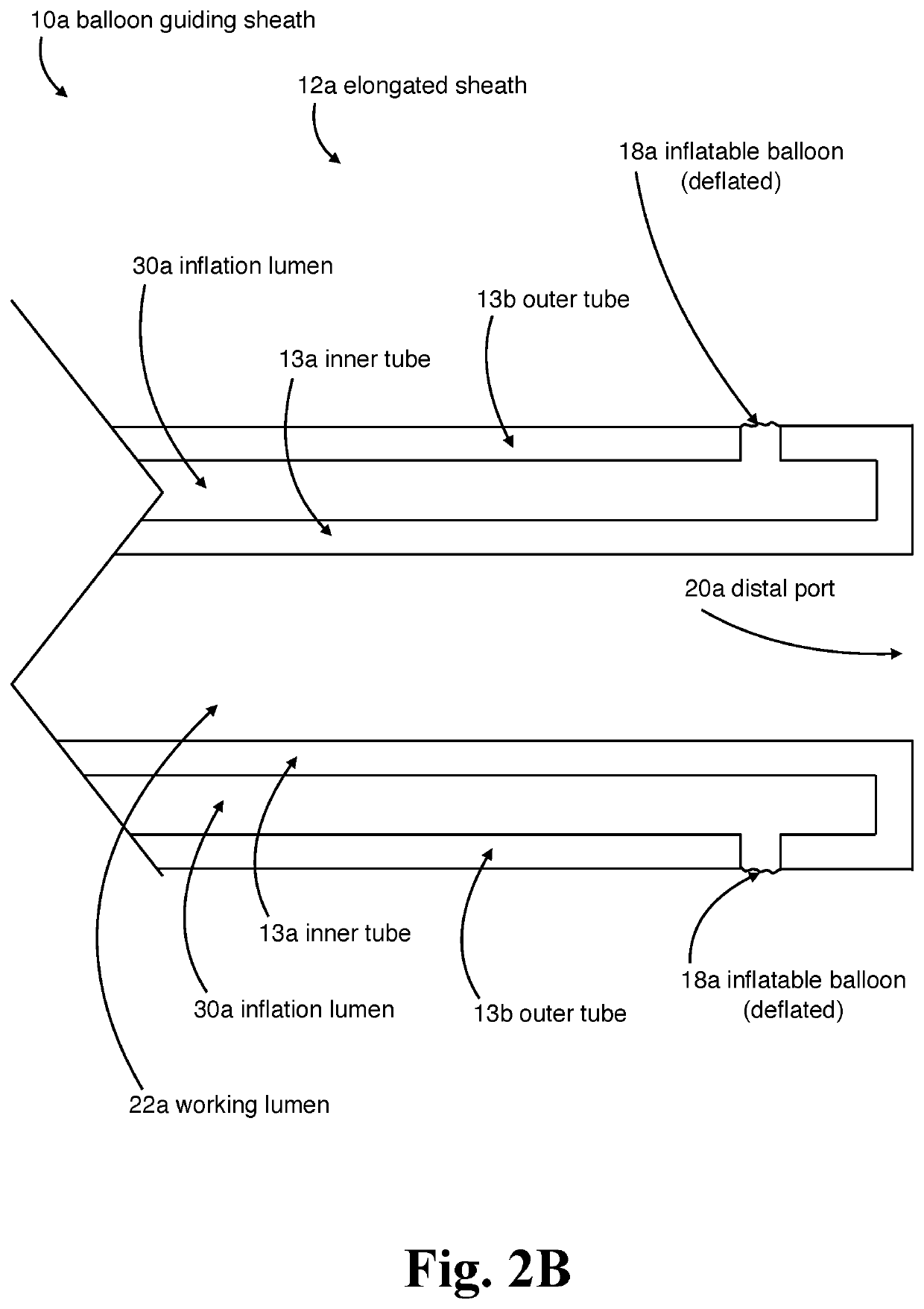 Internal carotid artery thrombectomy devices and methods