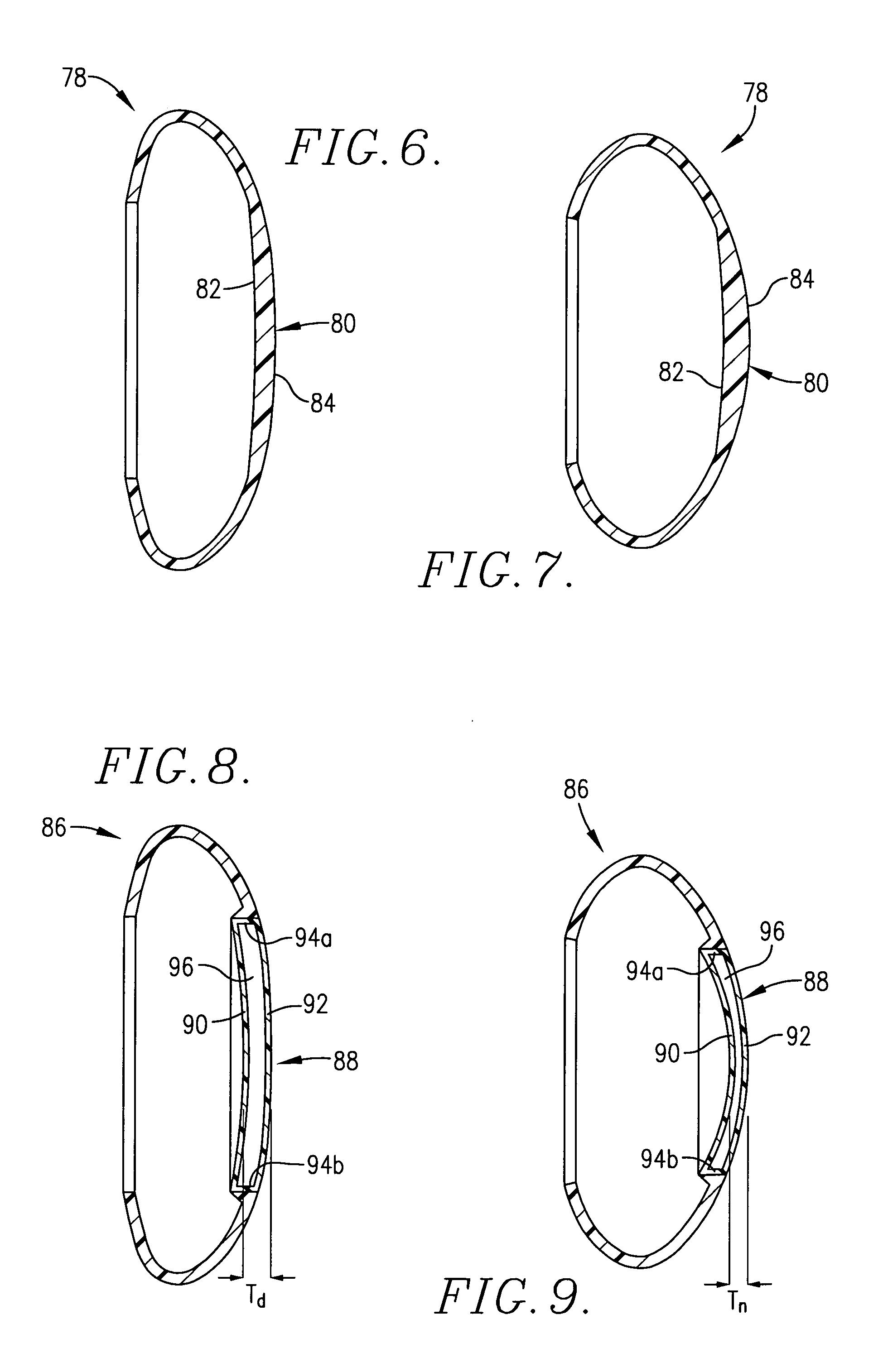 Intraocular lens implant having posterior bendable optic