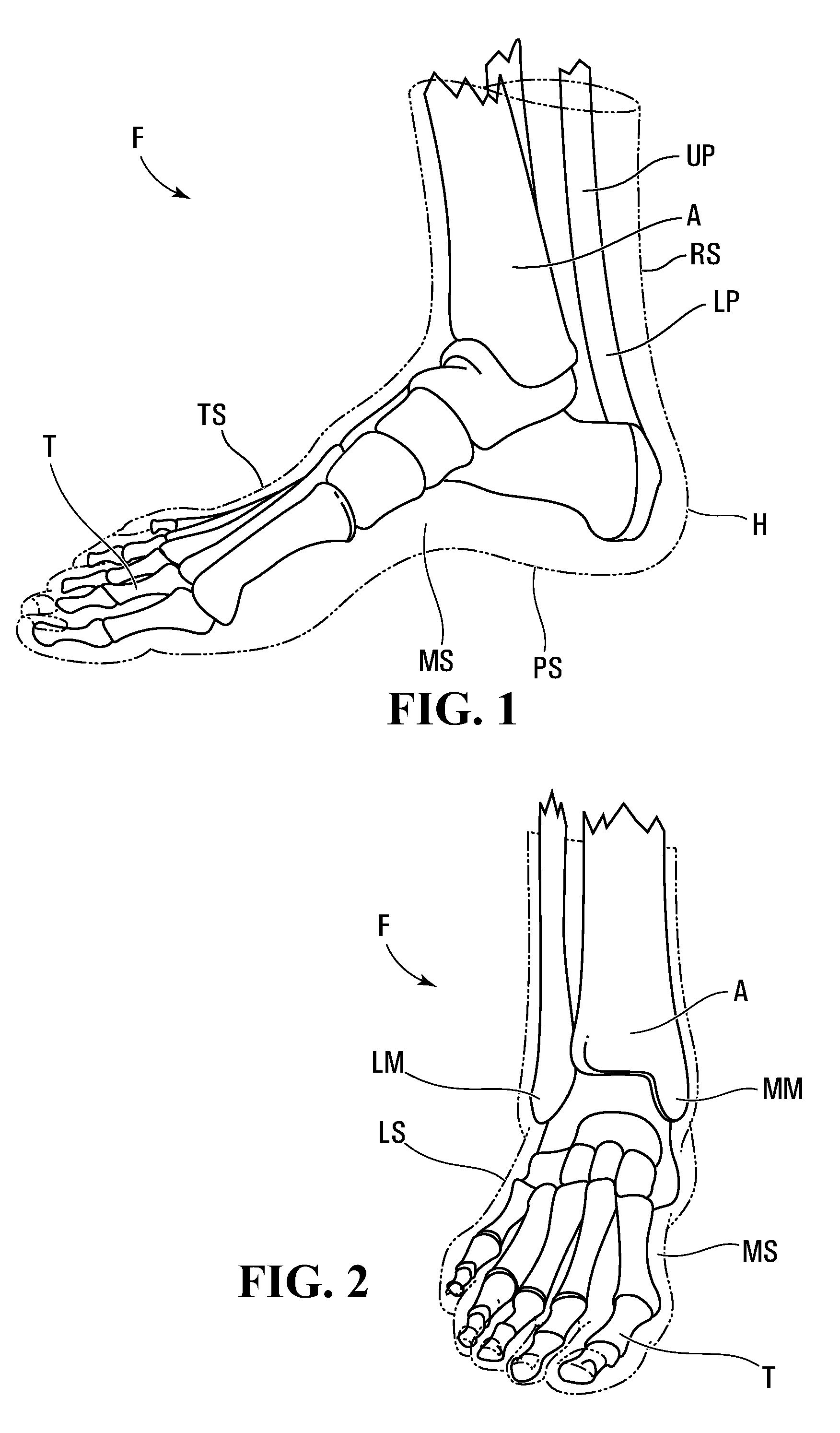 Skate boot having an inner liner with an abrasion resistant overlay