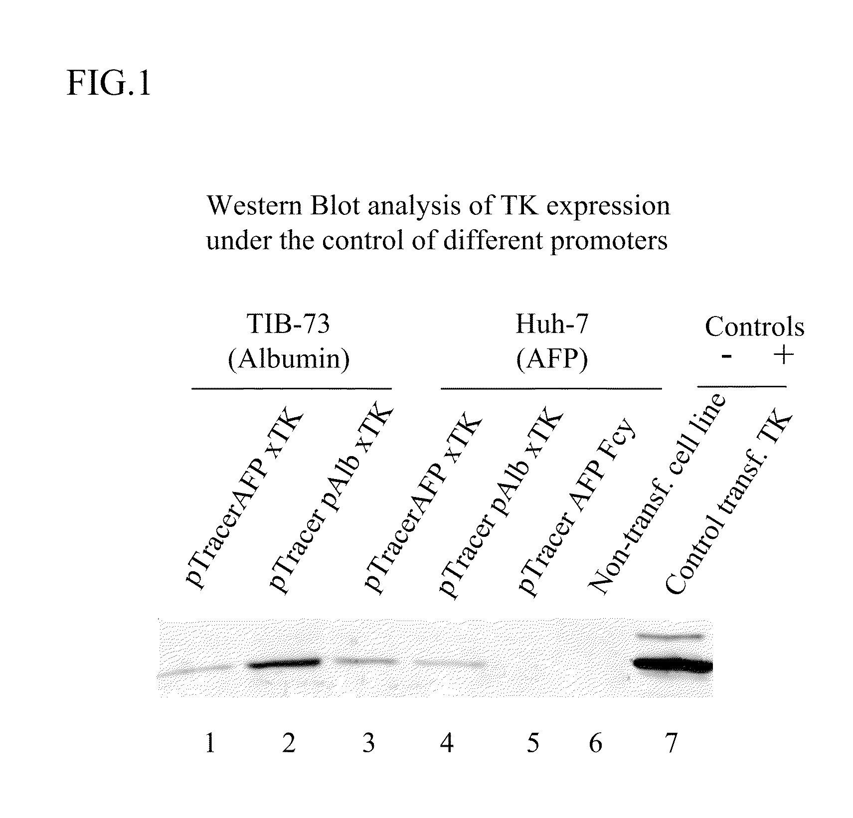 Growth of foreign cells after conditional and selective destruction of fetal host cells