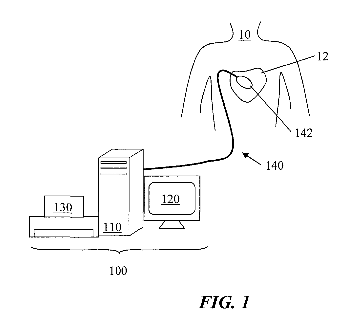 Method and device for determining and presenting surface charge and dipole densities on cardiac walls