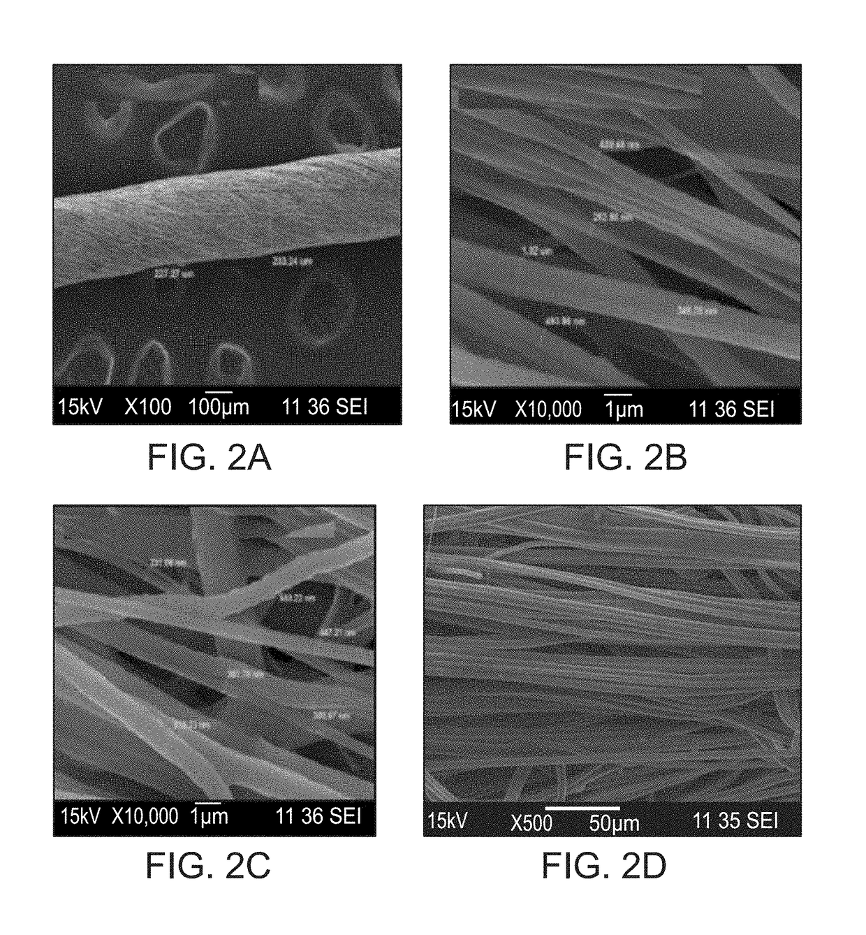 Suturable woven implants from electrospun yarns for sustained drug release in body cavities