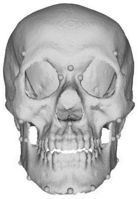 Criminology-oriented computer-assisted facial reconstruction method for skulls of unknown body sources