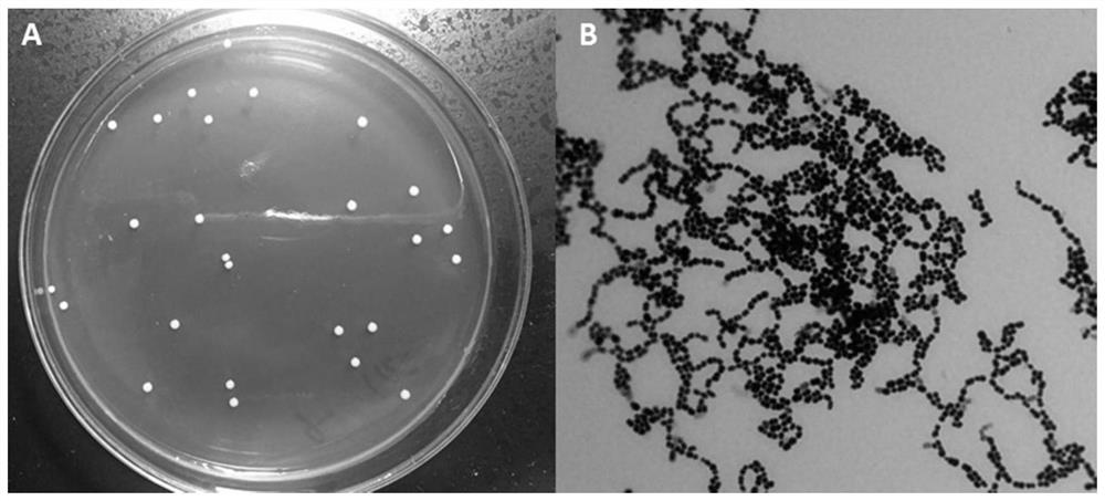 Lactococcus lactis capable of improving oral health and application of lactococcus lactis