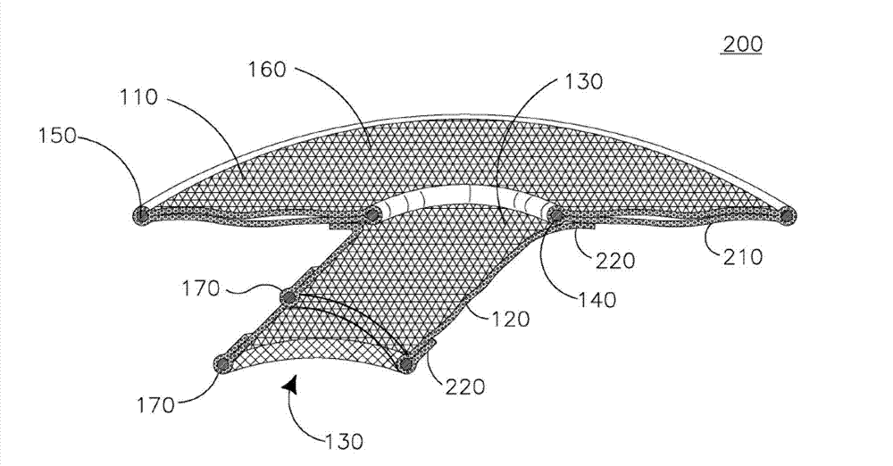 Stoma stabilitating device and method