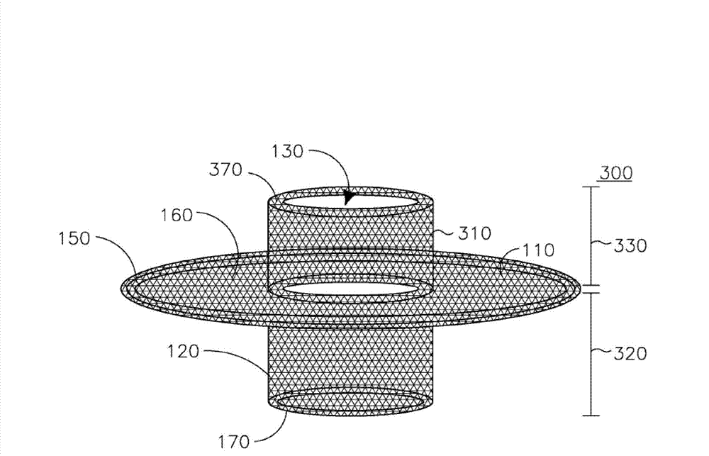 Stoma stabilitating device and method