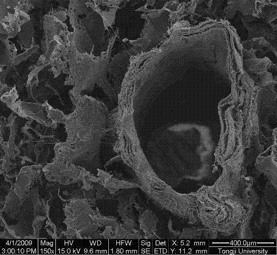 Method for preparing aqueous gel/nano hydroxyapatite composite scaffold for hard tissue repair