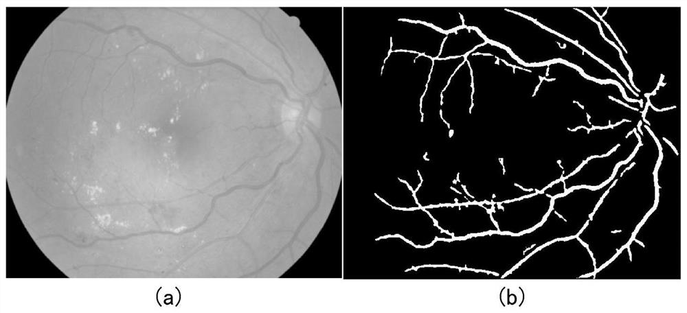 A Diabetic Retinopathy Detection System Based on Sequential Structural Segmentation