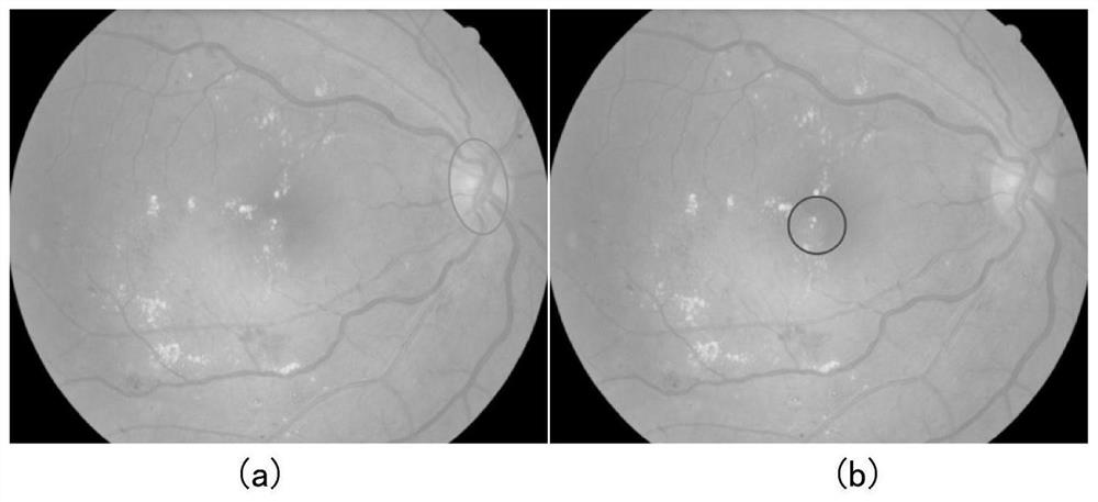A Diabetic Retinopathy Detection System Based on Sequential Structural Segmentation