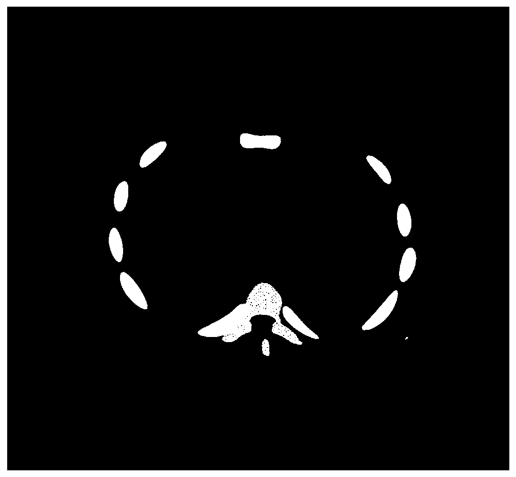 Multi-energy-spectrum segmented sparse scanning iterative reconstruction method based on traditional single-energy CT