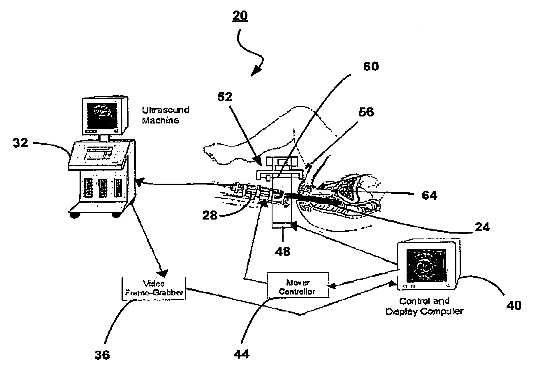 Apparatus and computing device for performing brachytherapy and methods of imaging using the same