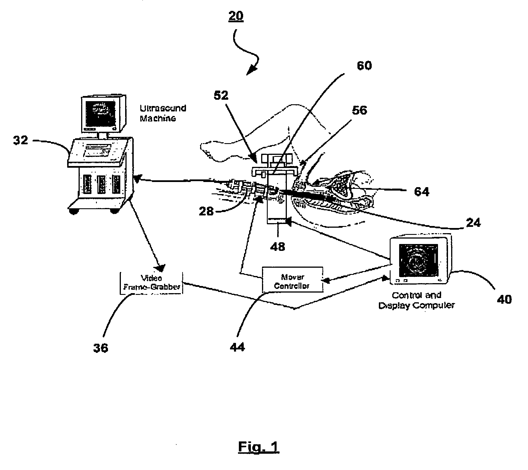 Apparatus and computing device for performing brachytherapy and methods of imaging using the same