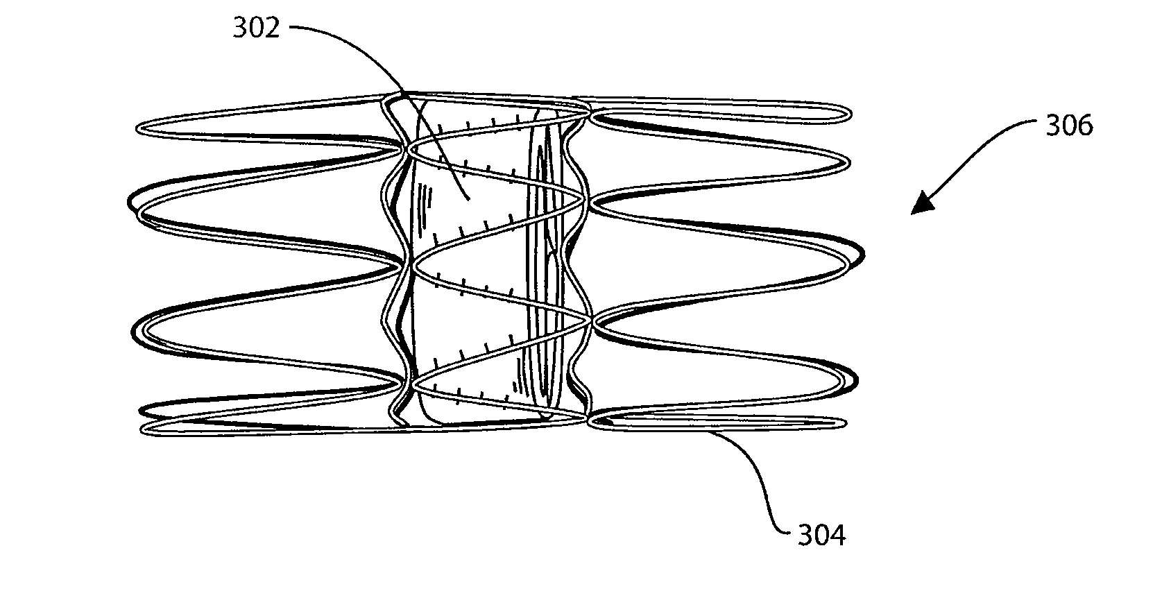 Catheter delivered valve having a barrier to provide an enhanced seal