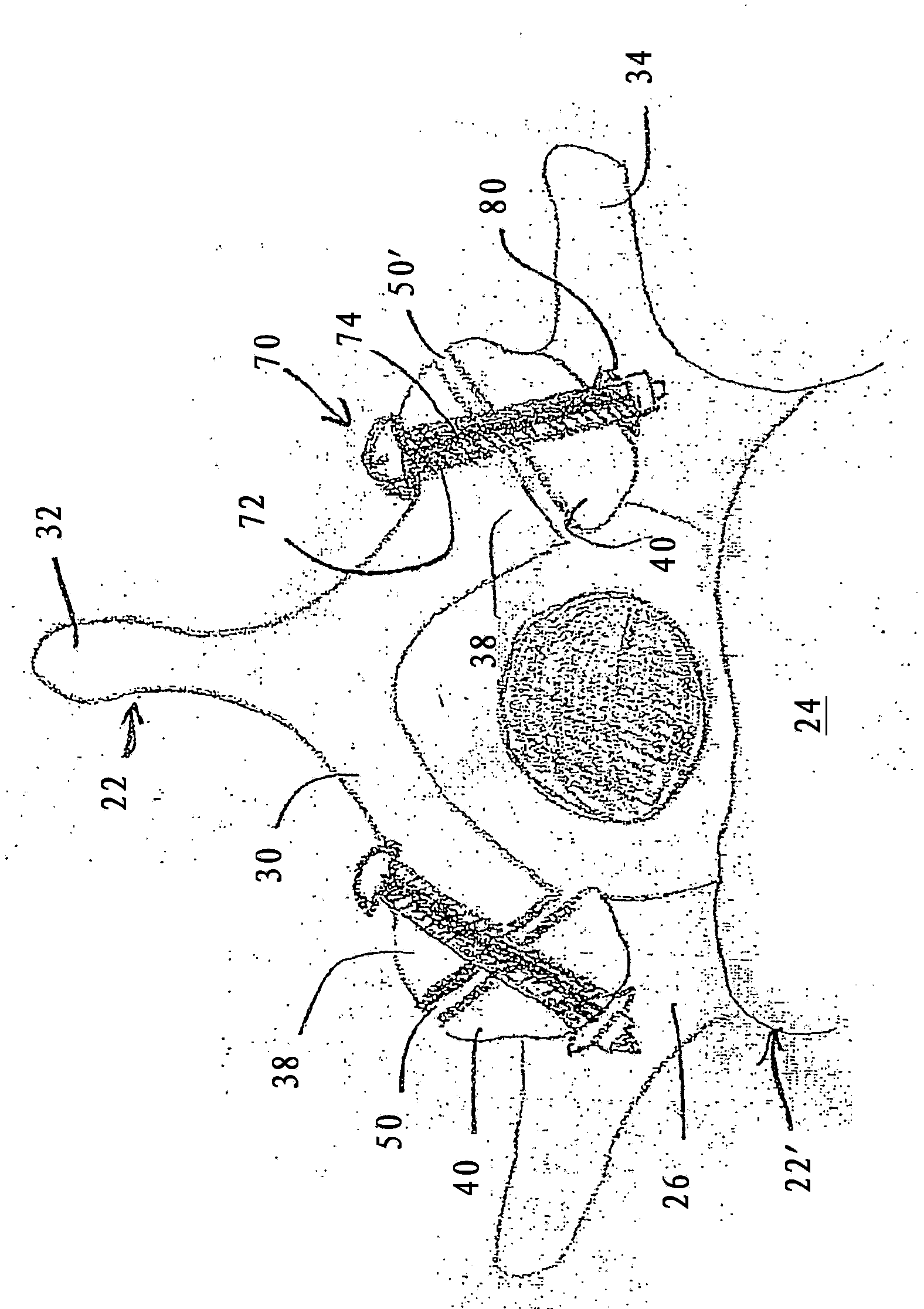 Bioactive fusion device