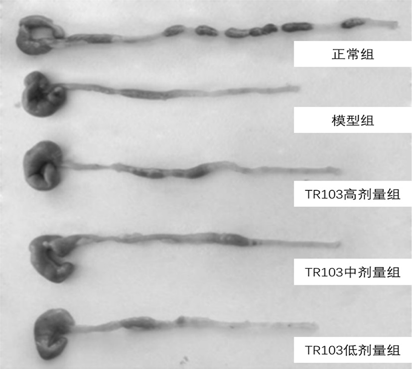 Bifidobacterium breve and application thereof