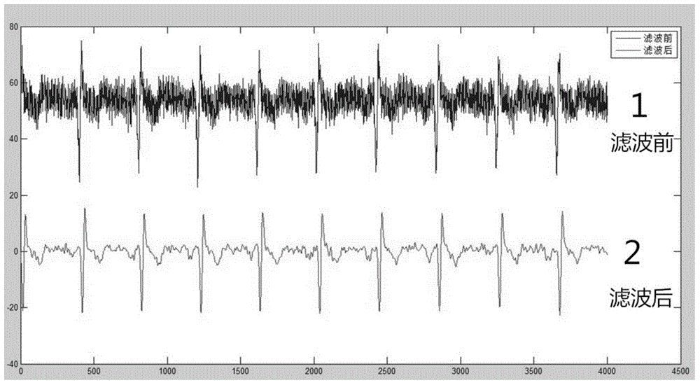 Mobile ECG signal qrs wave real-time wave detection method and device