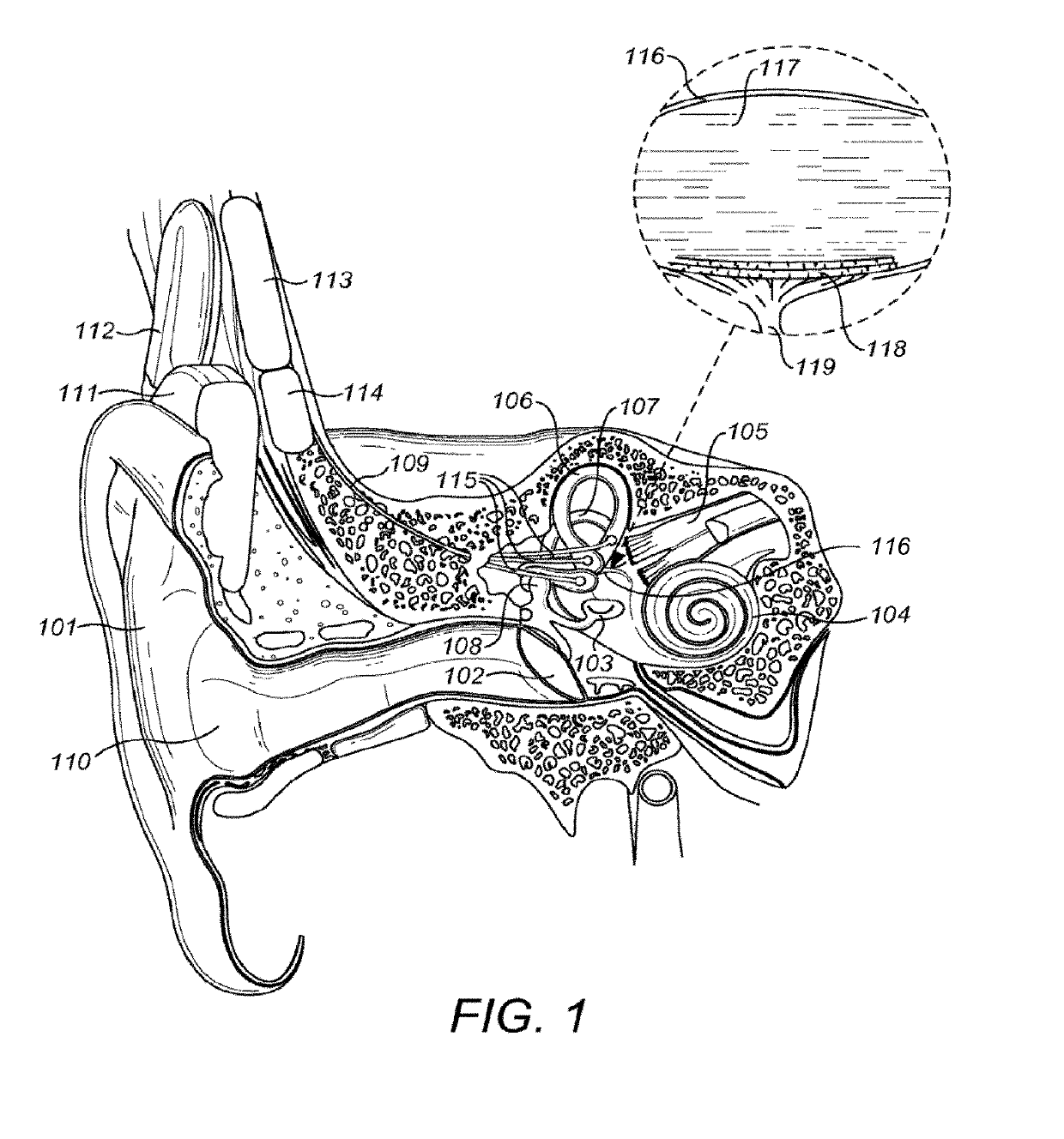 Opto-Acoustic Selective Mechanical Stimulation of the Vestibular System ...