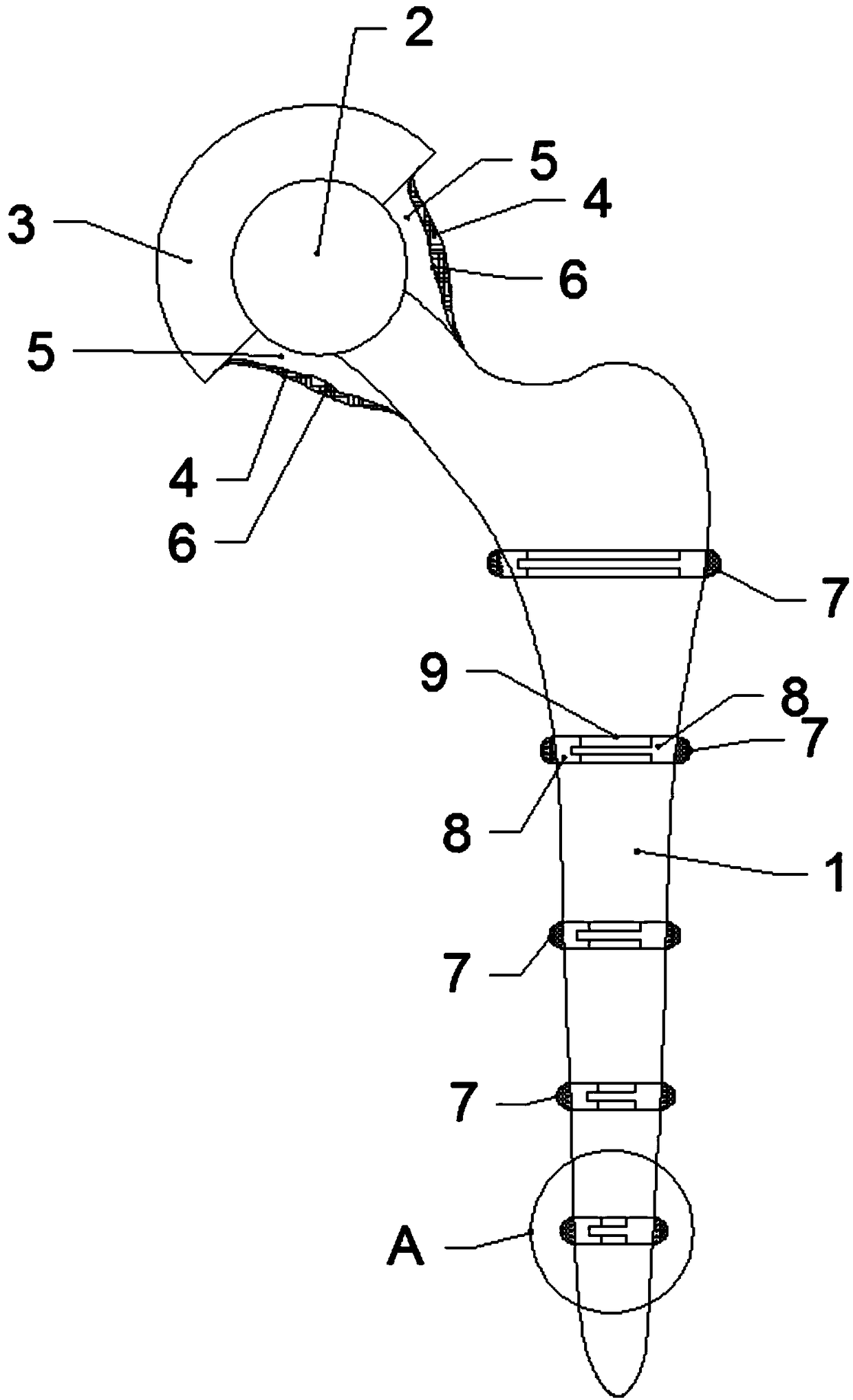 Novel titanium alloy joint stent coated with calcium phosphate bioactive ceramics