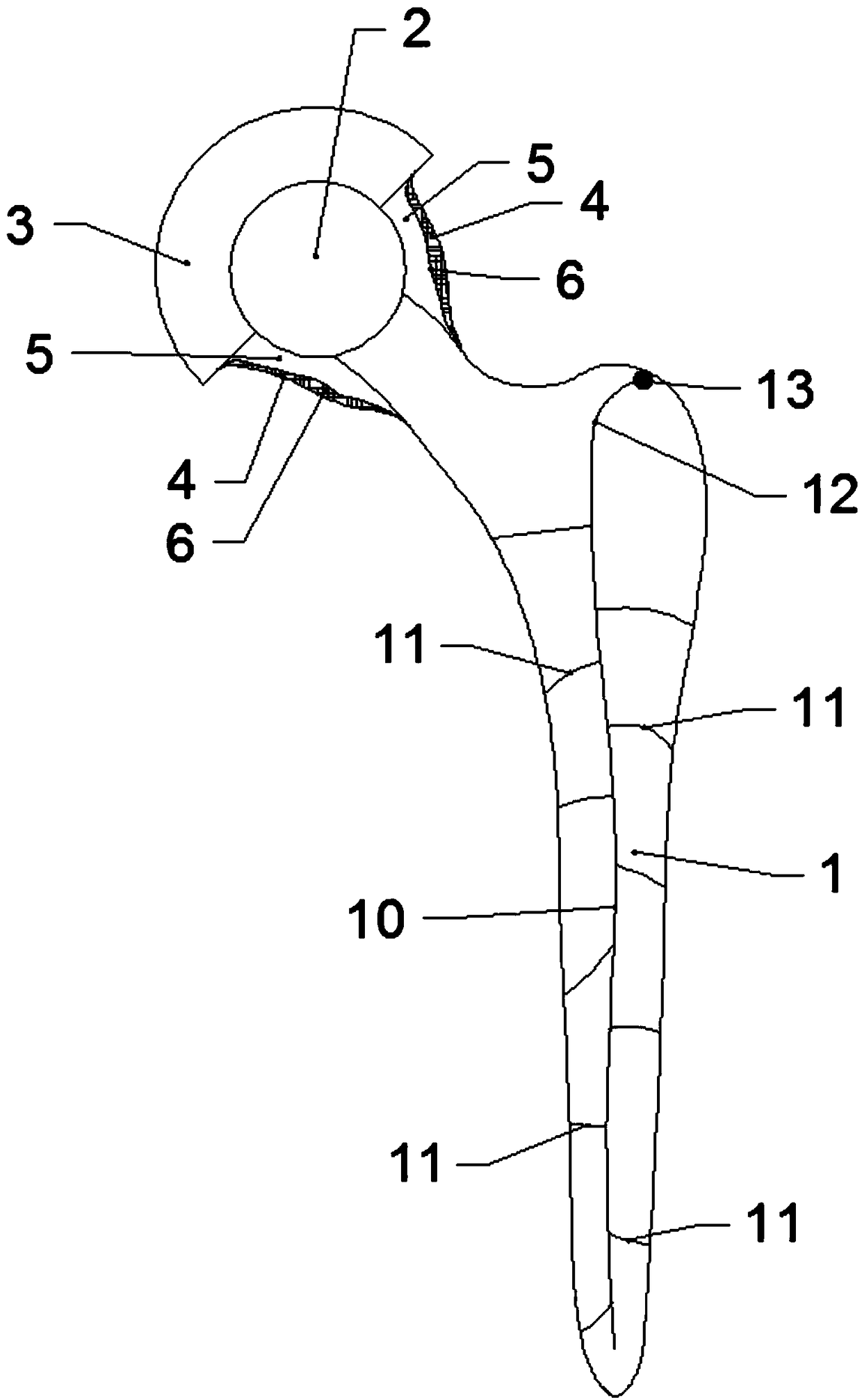 Novel titanium alloy joint stent coated with calcium phosphate bioactive ceramics