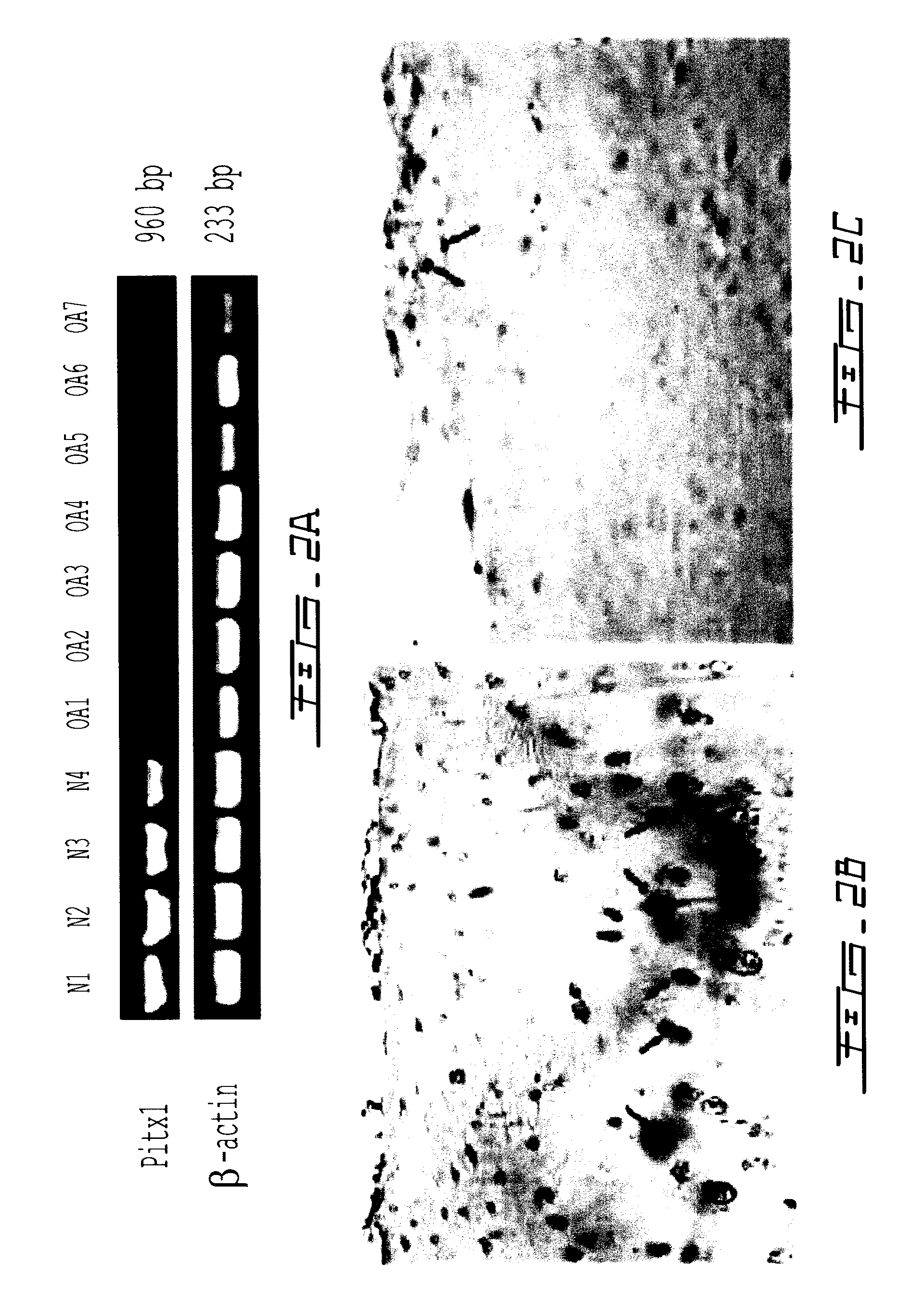 Methods for diagnosing osteoarthritis