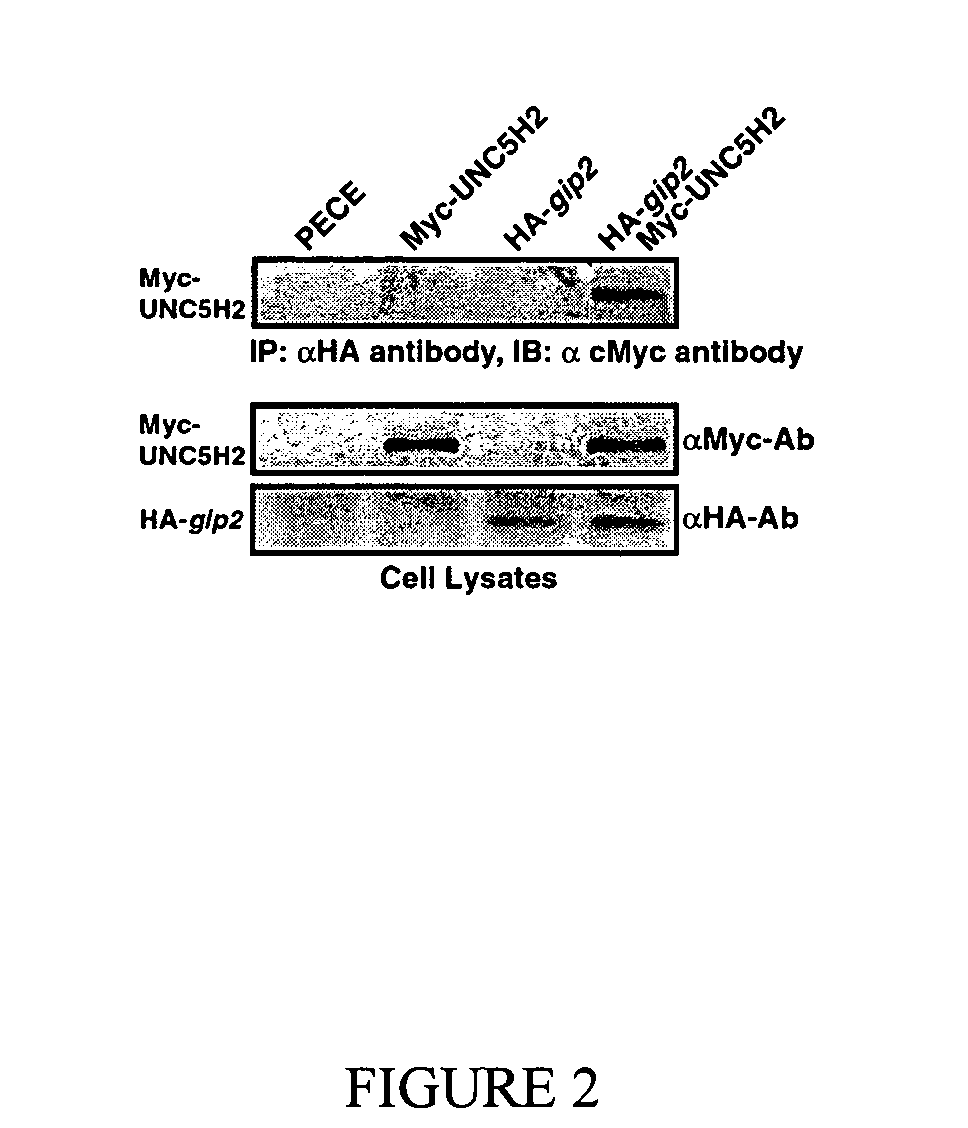 Netrin compositions and methods of using the same