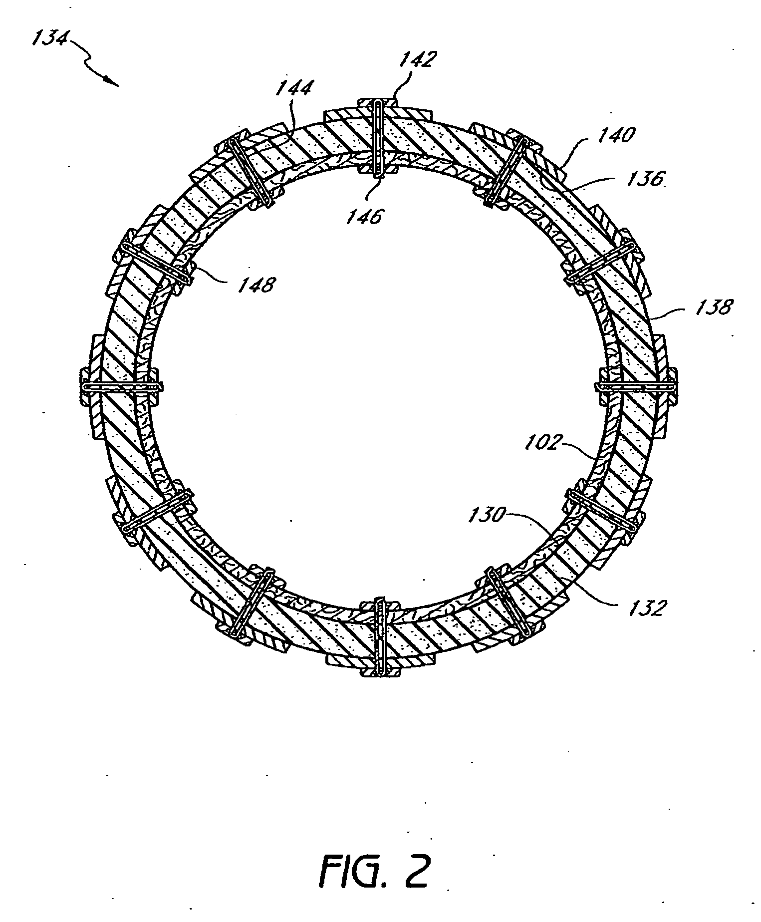 Cuff and sleeve system for gastrointestinal bypass