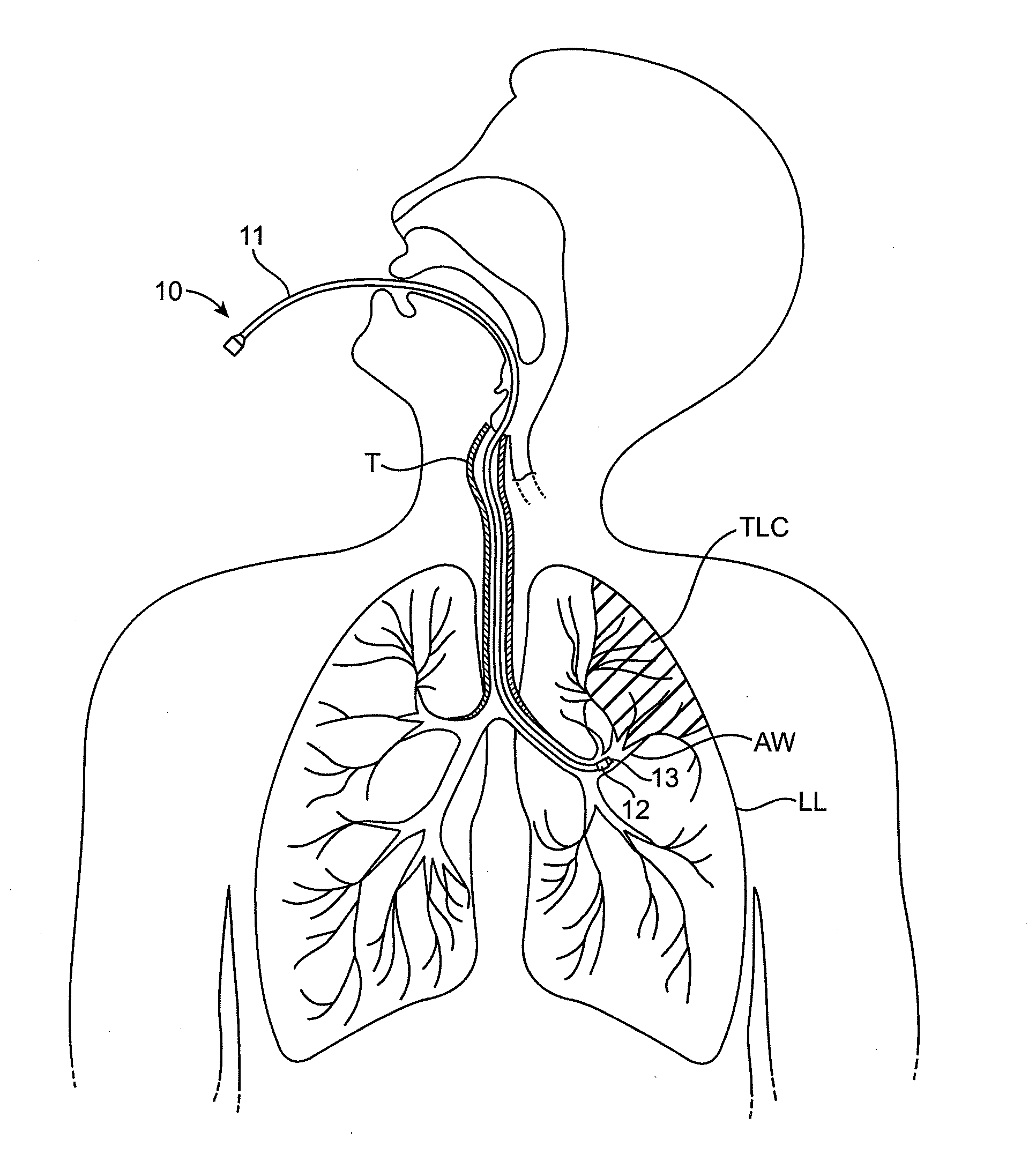 Methods and systems for assessing lung function and delivering therapeutic agents