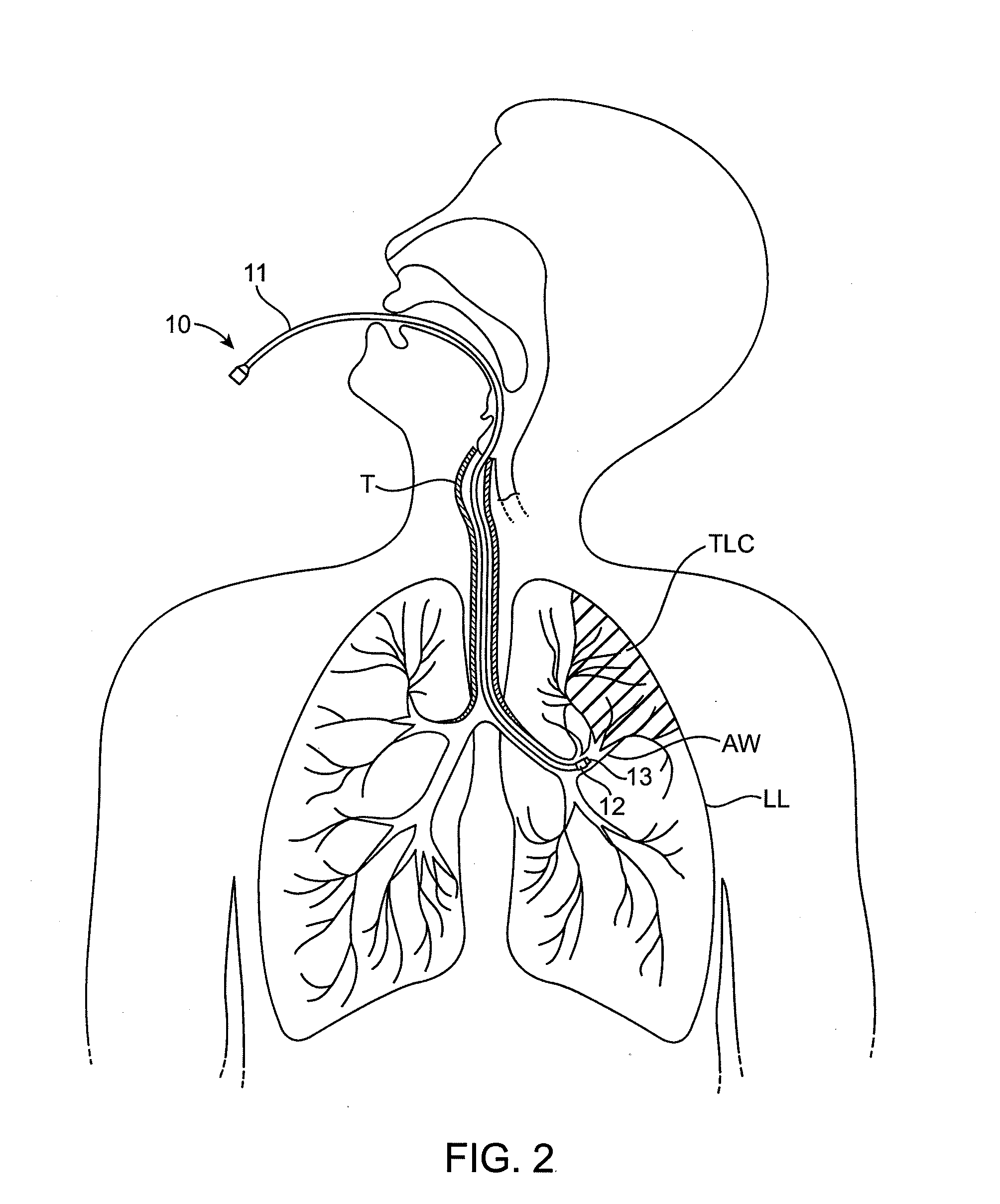Methods and systems for assessing lung function and delivering therapeutic agents