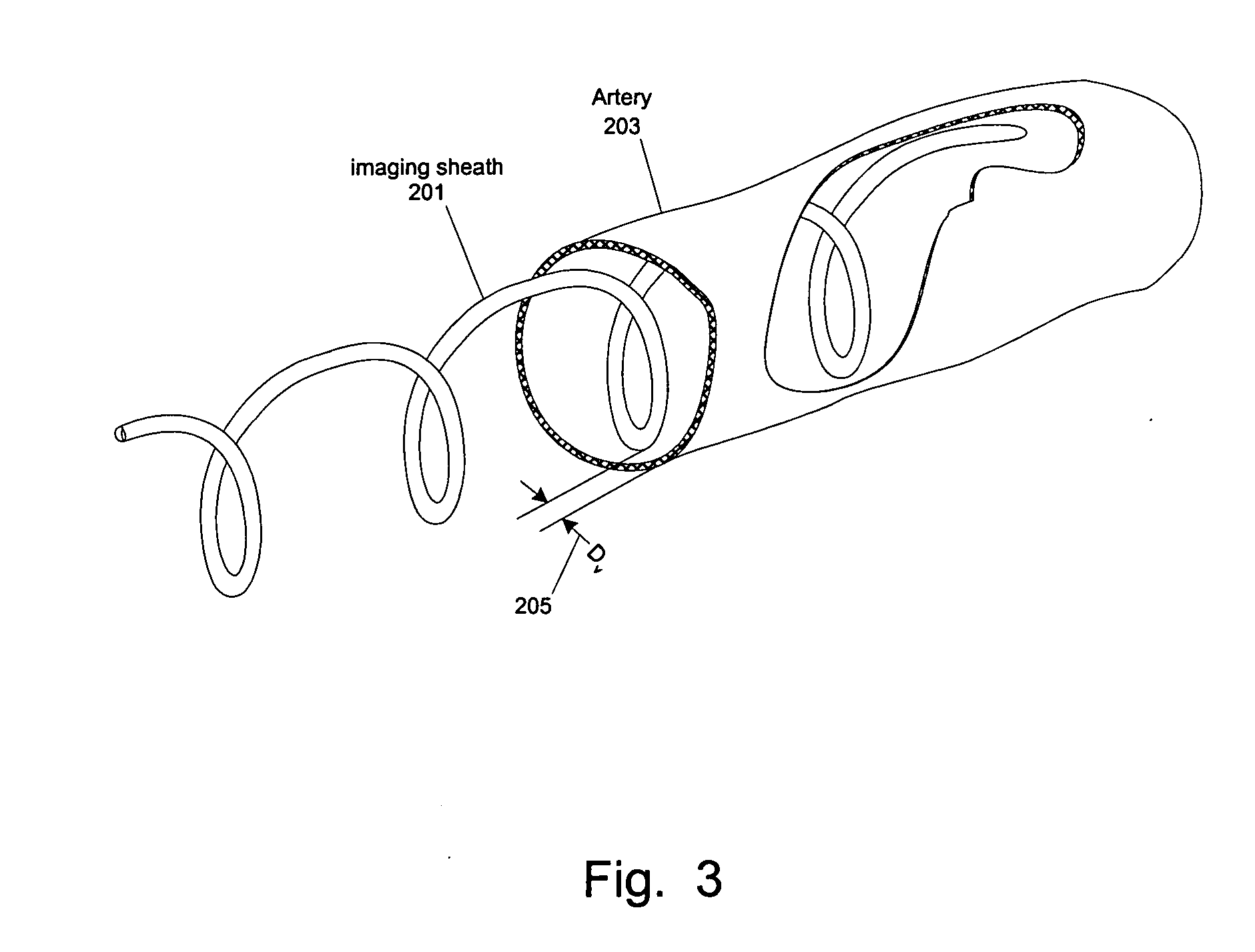 Methods and apparatuses for positioning within an internal channel