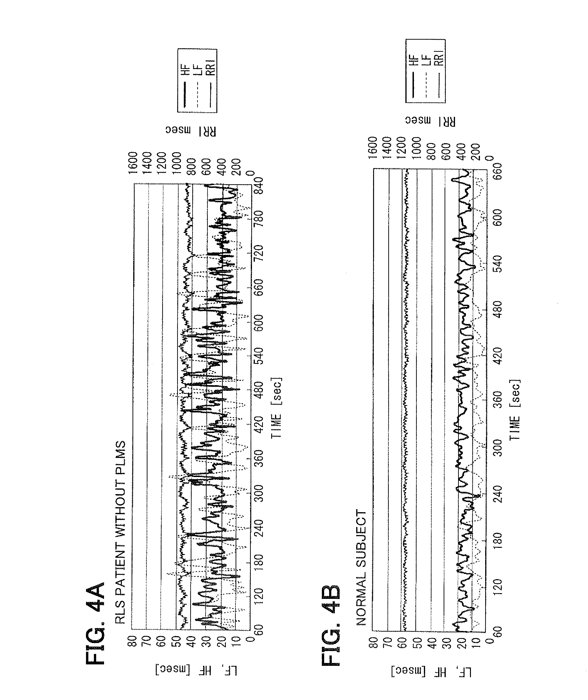 Living body inspection apparatus, and relevant method and program product