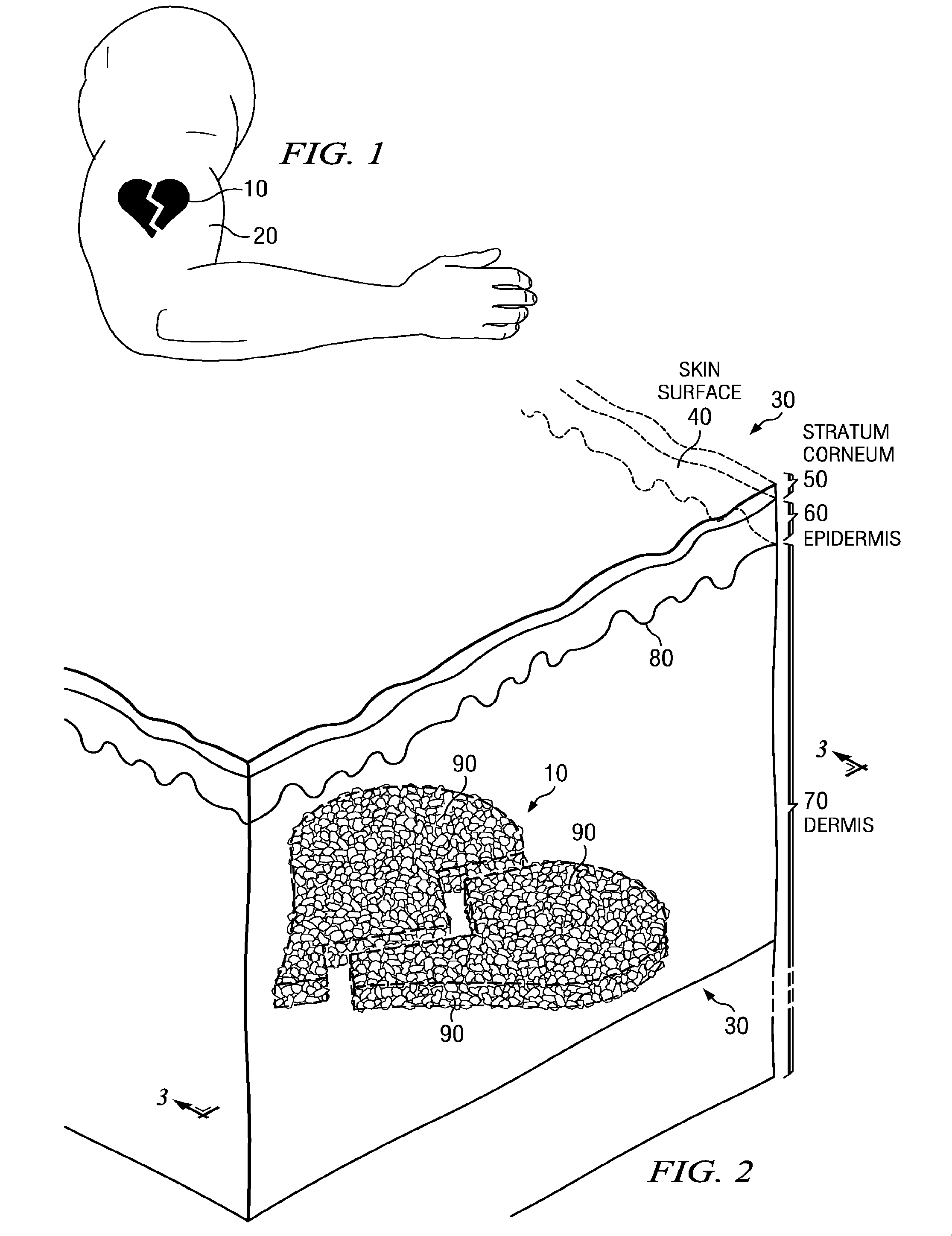 Optical Treatment Methods