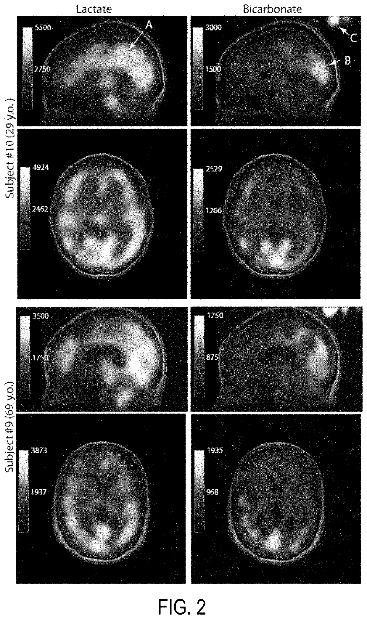 Systems and methods for metabolite topography of the brain with magnetic resonance imaging