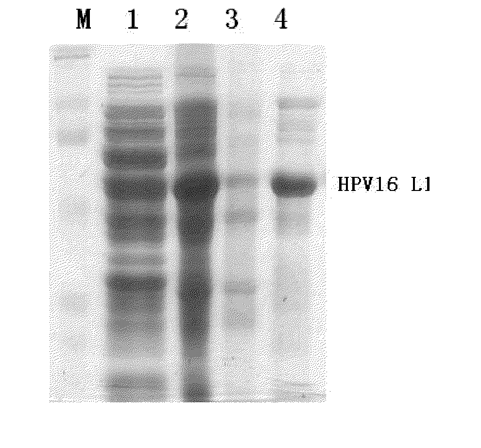 Truncated l1 protein of human papillomavirus type 16