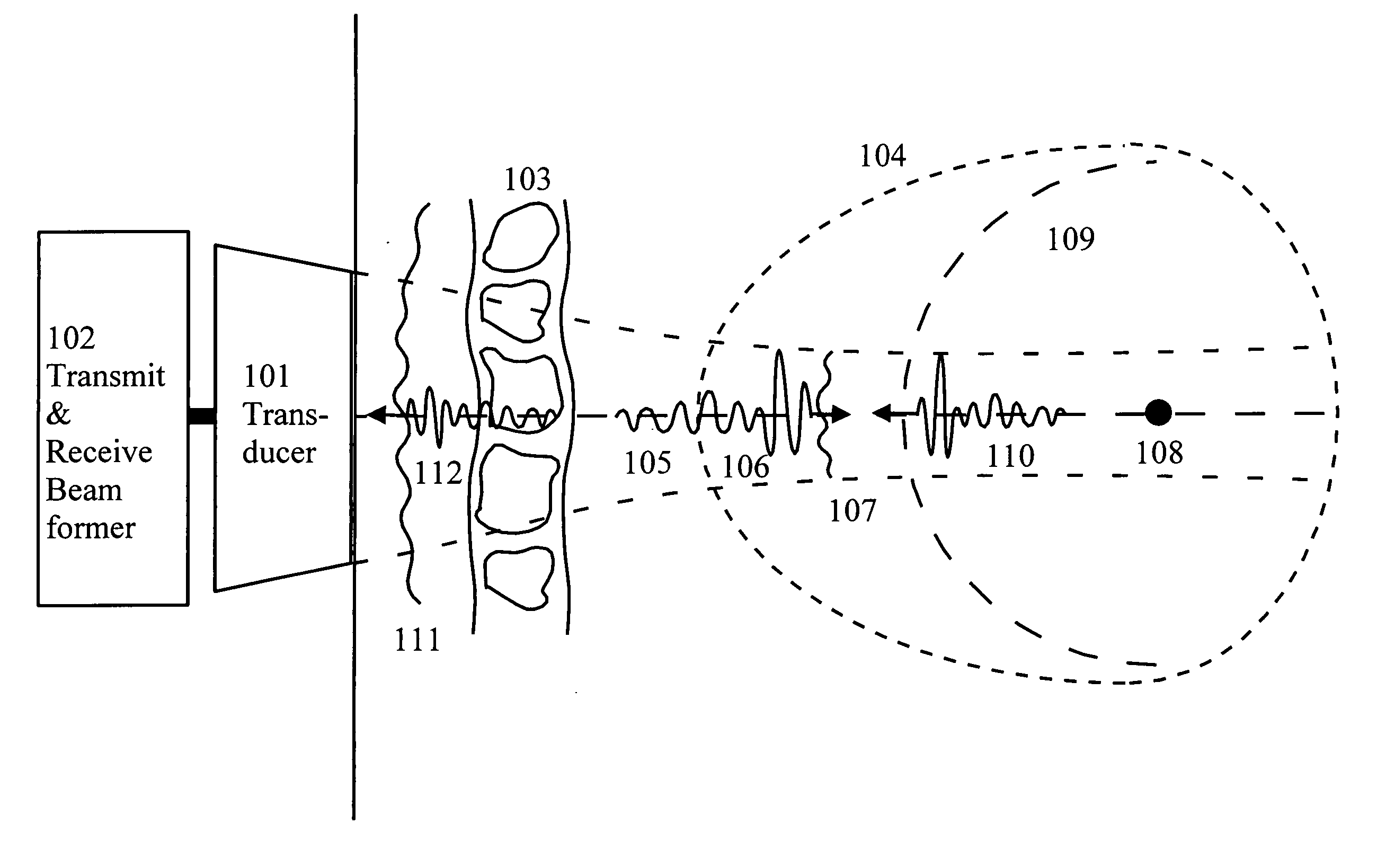 Corrections for wavefront aberrations in ultrasound imaging