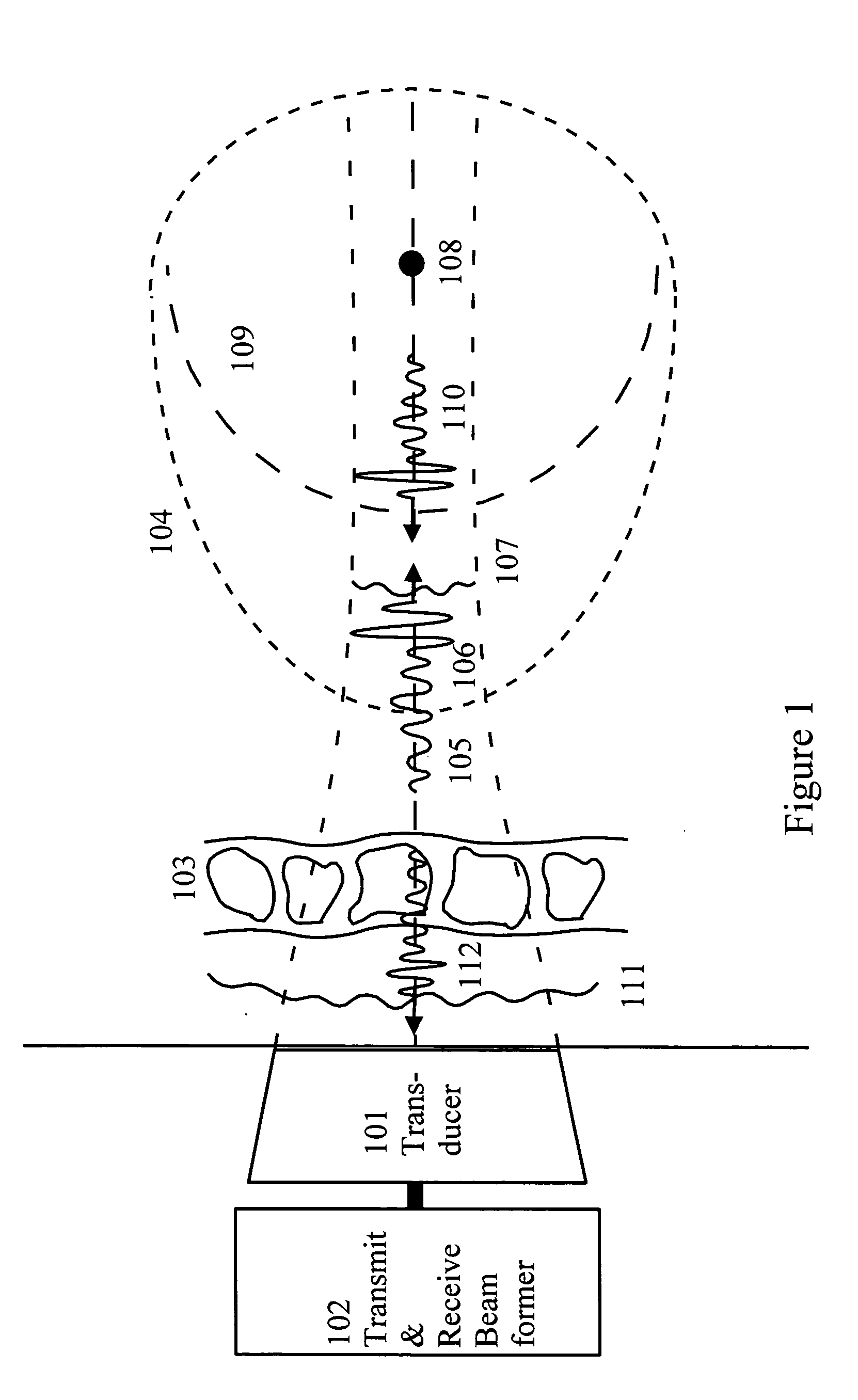 Corrections for wavefront aberrations in ultrasound imaging