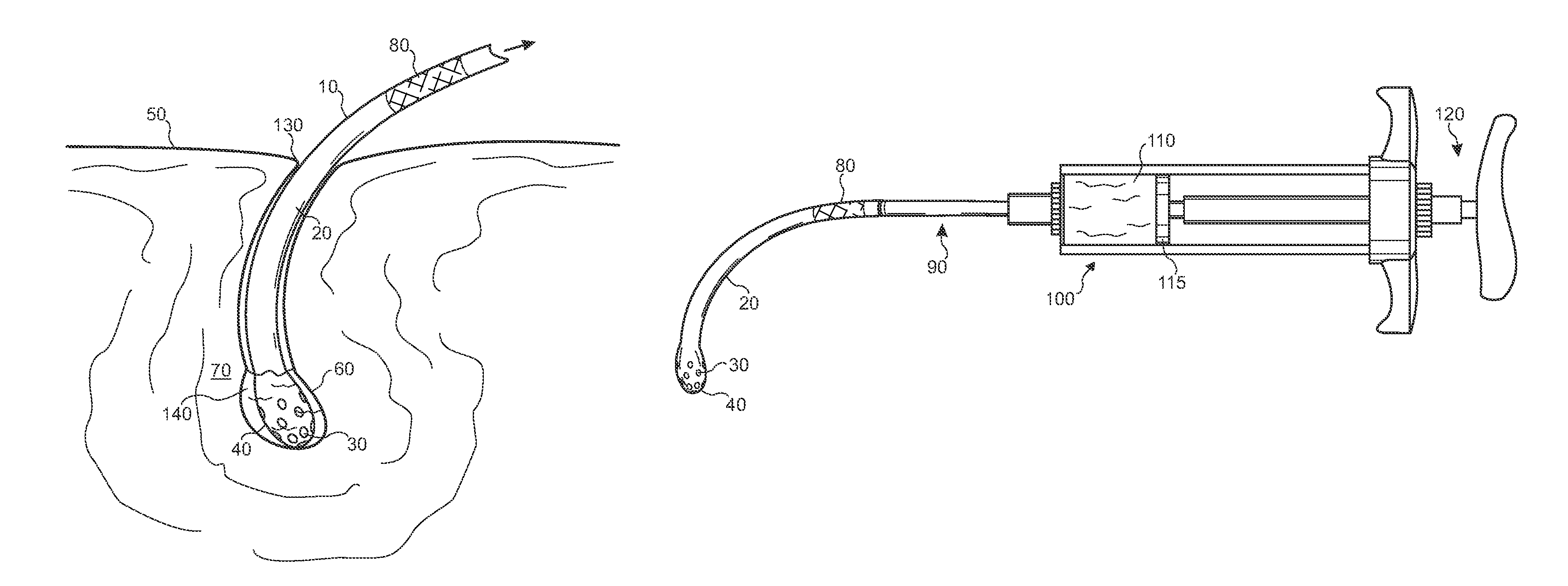 Snake venom evacuation and medication injection device