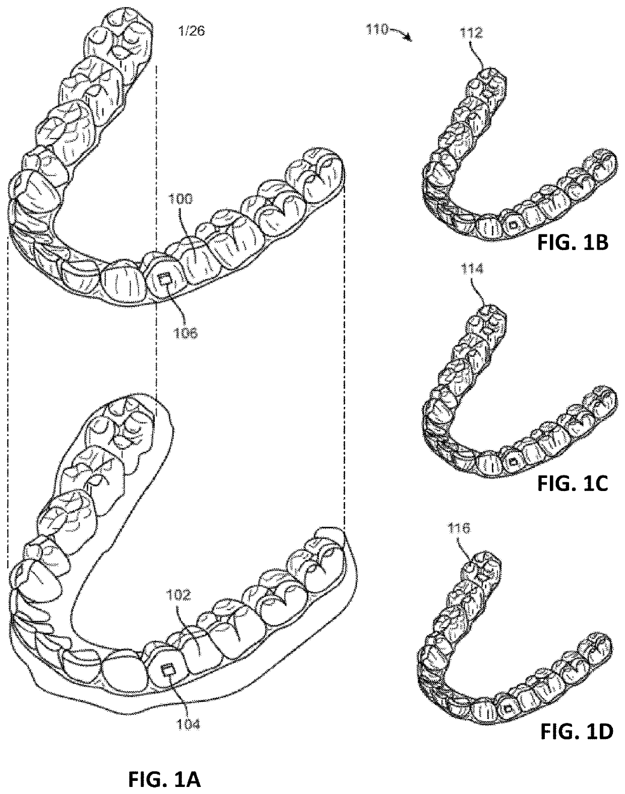 Intraoral appliances with proximity and contact sensing