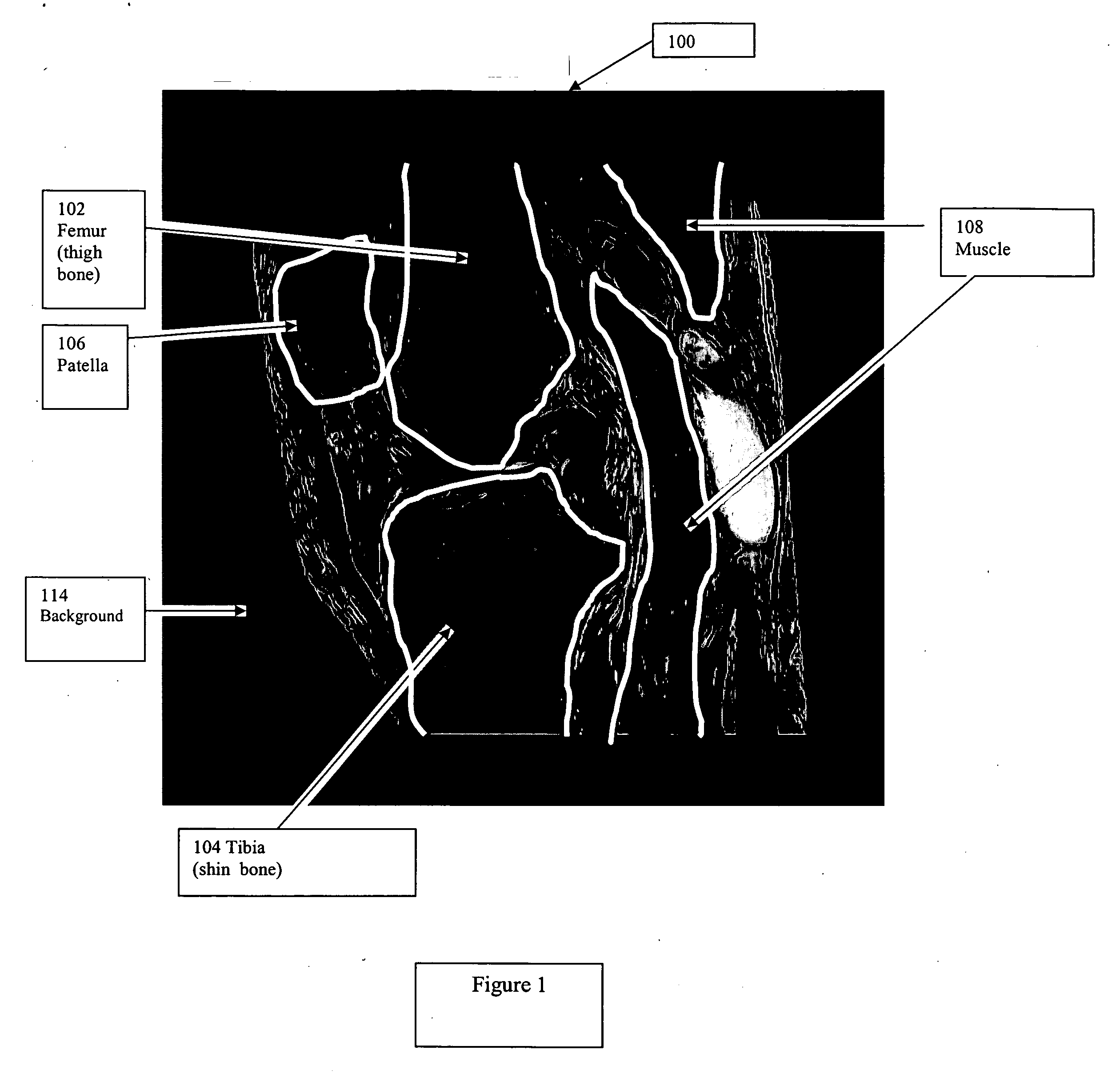 Method and apparatus for boundary-based image compression