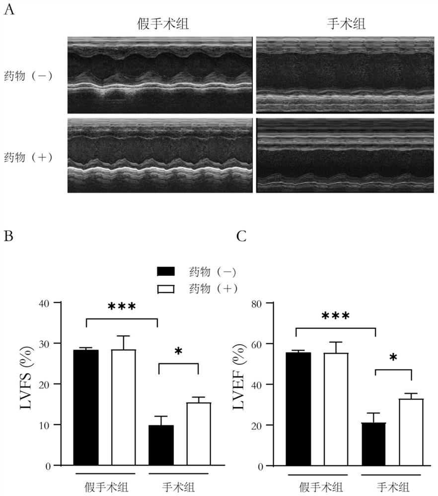 Application of bakuchiol in preparation of medicine for treating acute myocardial infarction