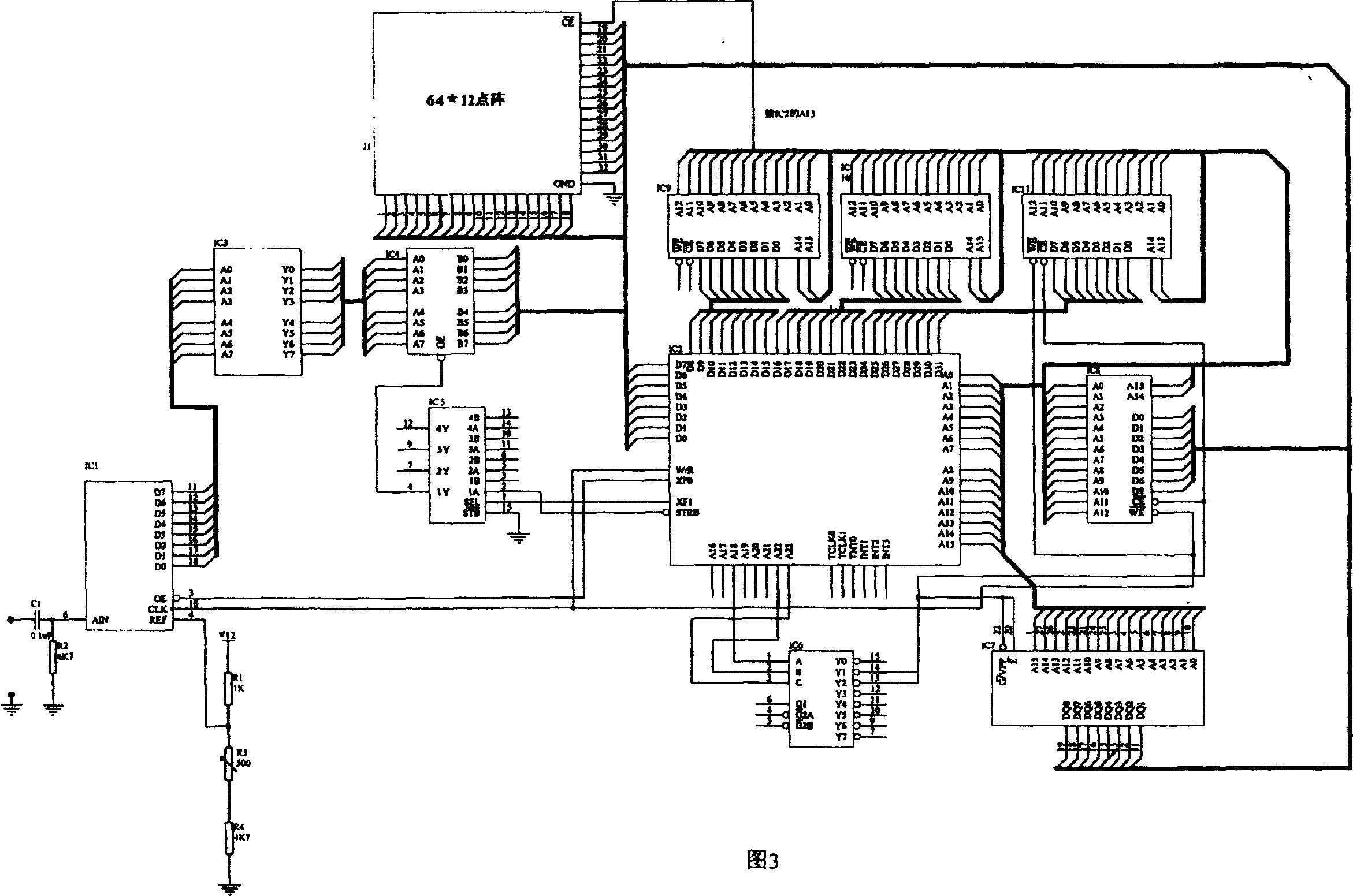 Automatic character recognition system for X ray image of mammary gland symptoms of the illness