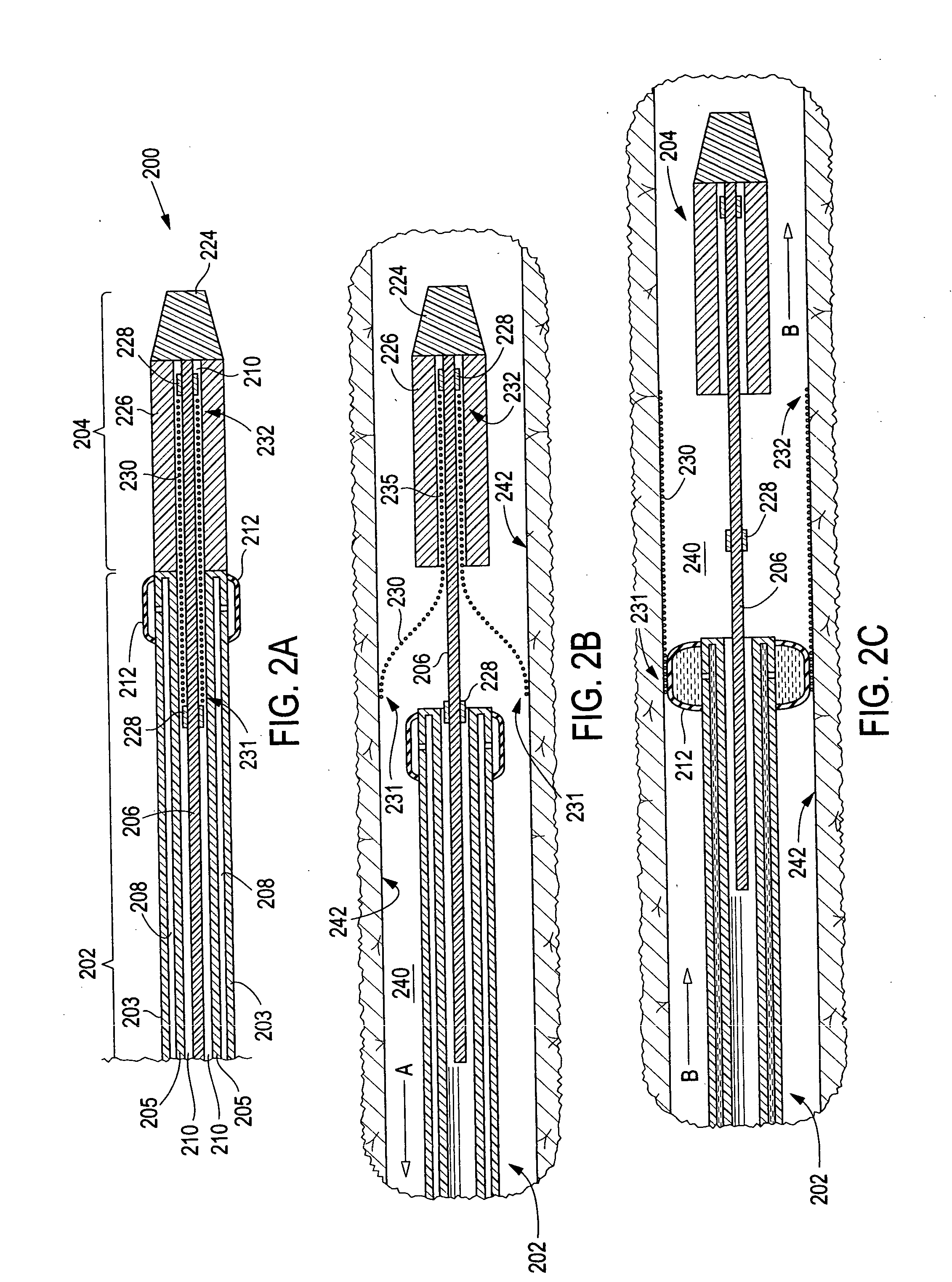 Apparatus and method for deployment of an endoluminal device