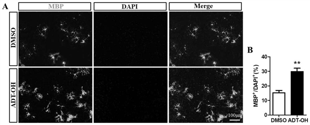 Application of hydrogen sulfide slow-release organic donor ADT-OH in preparation of medicine for treating nervous system diseases