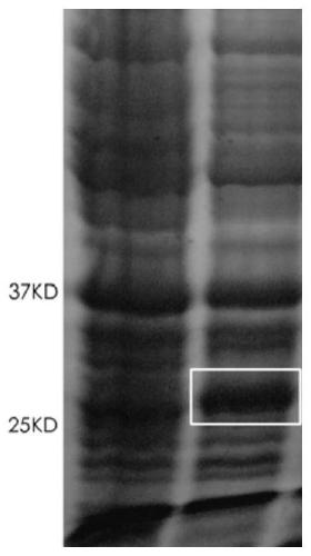 human cd70 antigen binding polypeptide